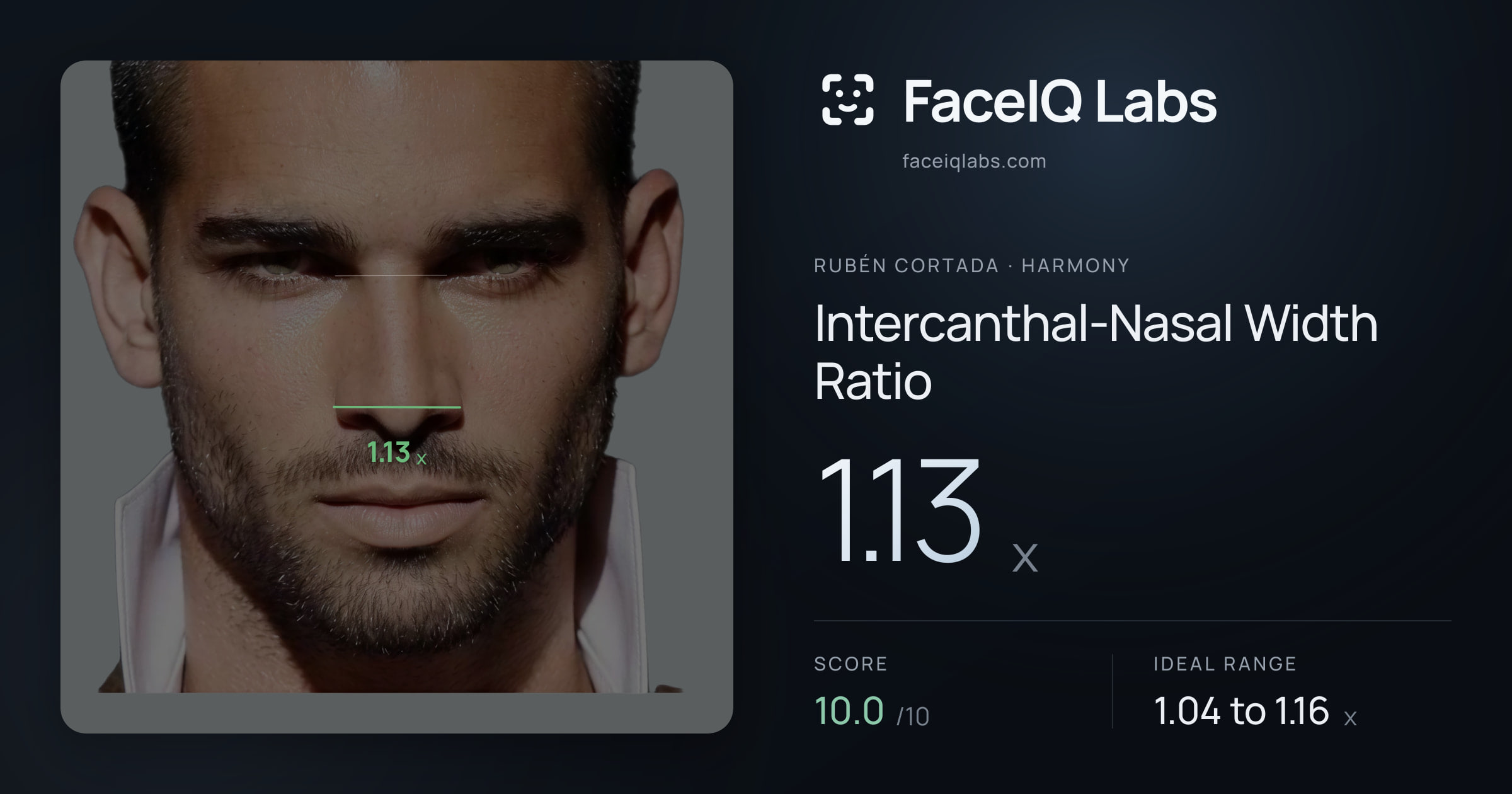 Rubén Cortada Intercanthal-Nasal Width Ratio: 1.13x, drawn on the photo