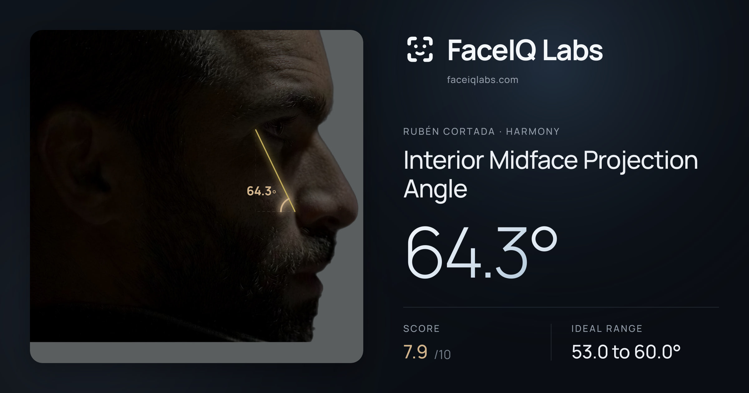 Rubén Cortada Interior Midface Projection Angle: 64.3°, drawn on the photo