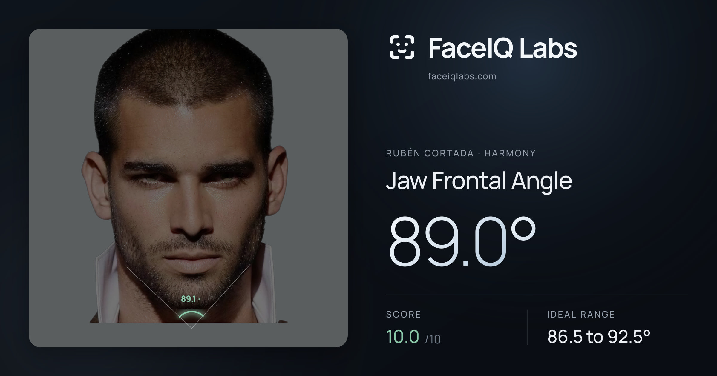 Rubén Cortada Jaw Frontal Angle: 89.0°, drawn on the photo