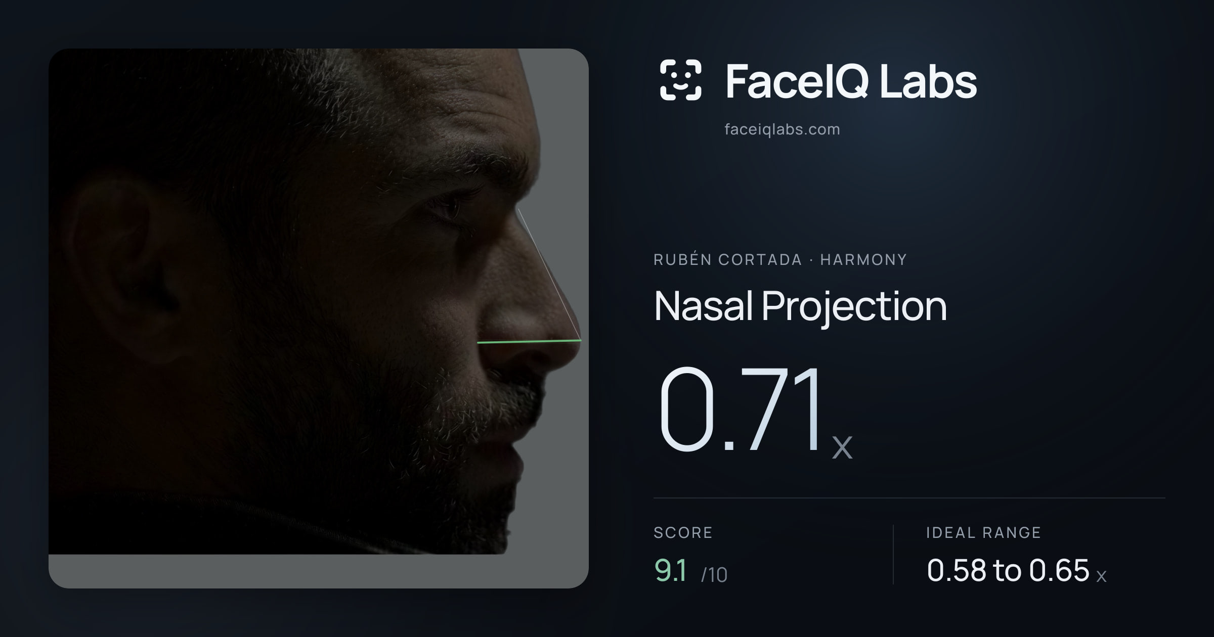 Rubén Cortada Nasal Projection: 0.71x, drawn on the photo