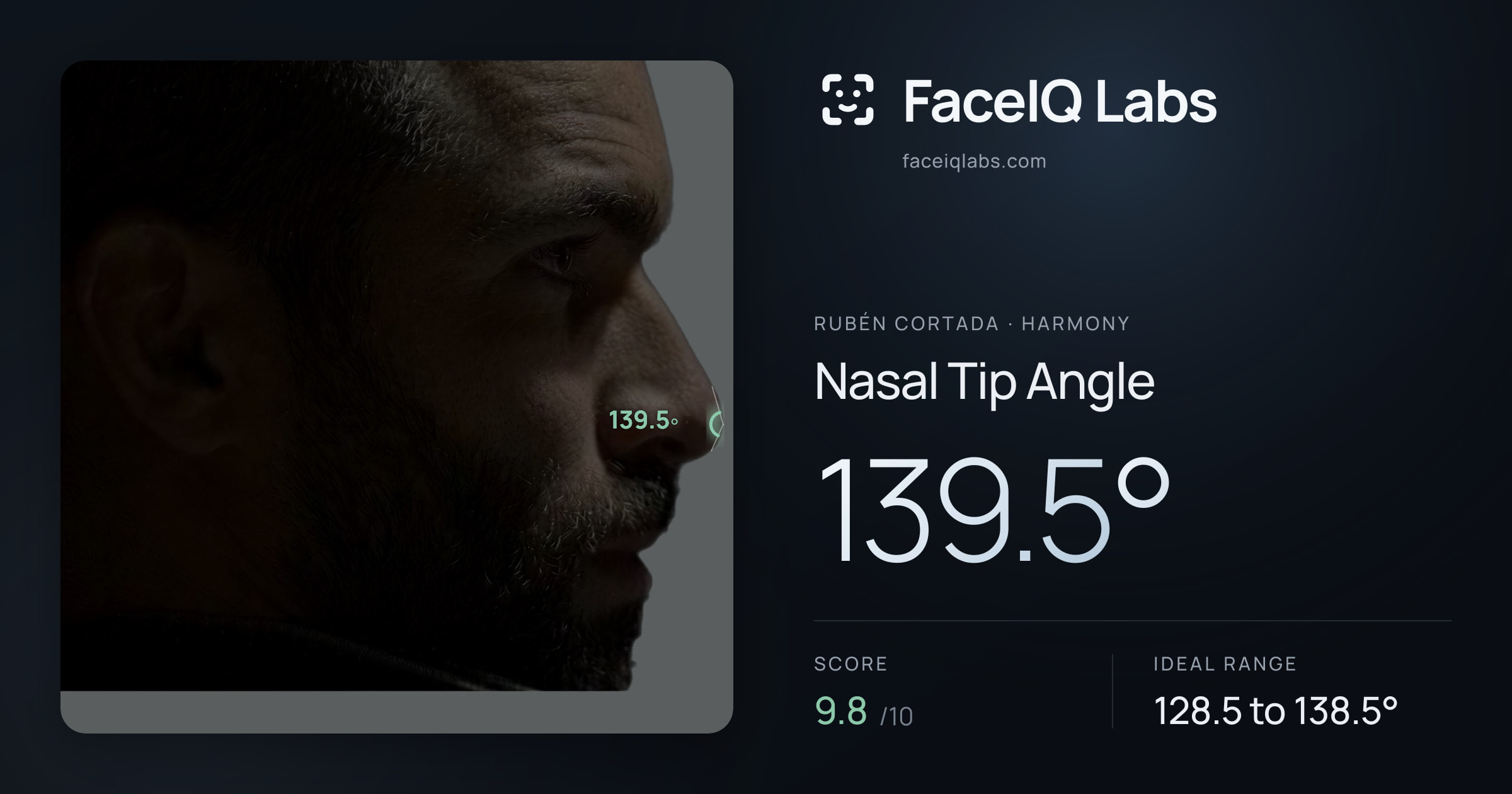 Rubén Cortada Nasal Tip Angle: 139.5°, drawn on the photo