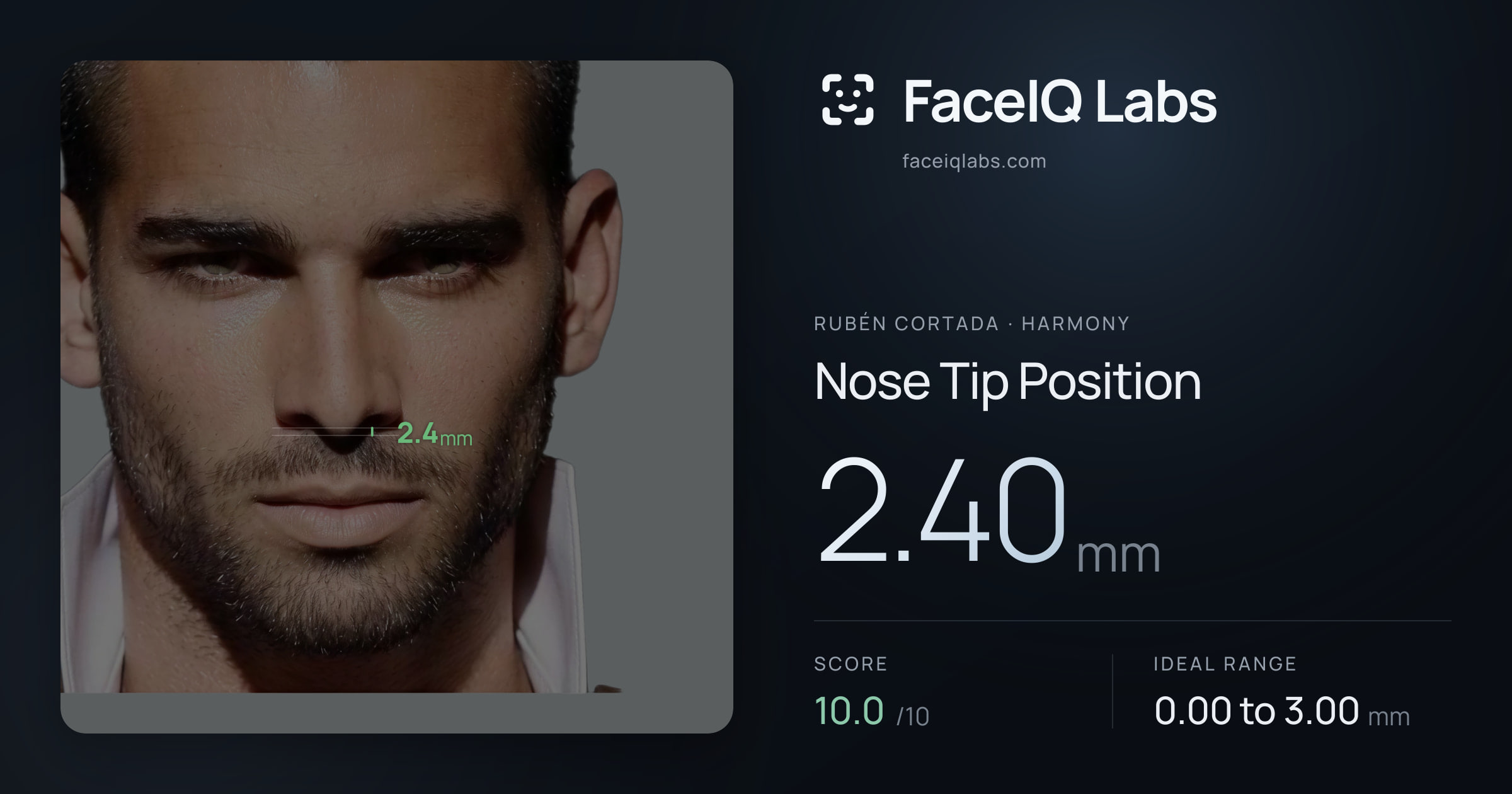 Rubén Cortada Nose Tip Position: 2.40mm, drawn on the photo