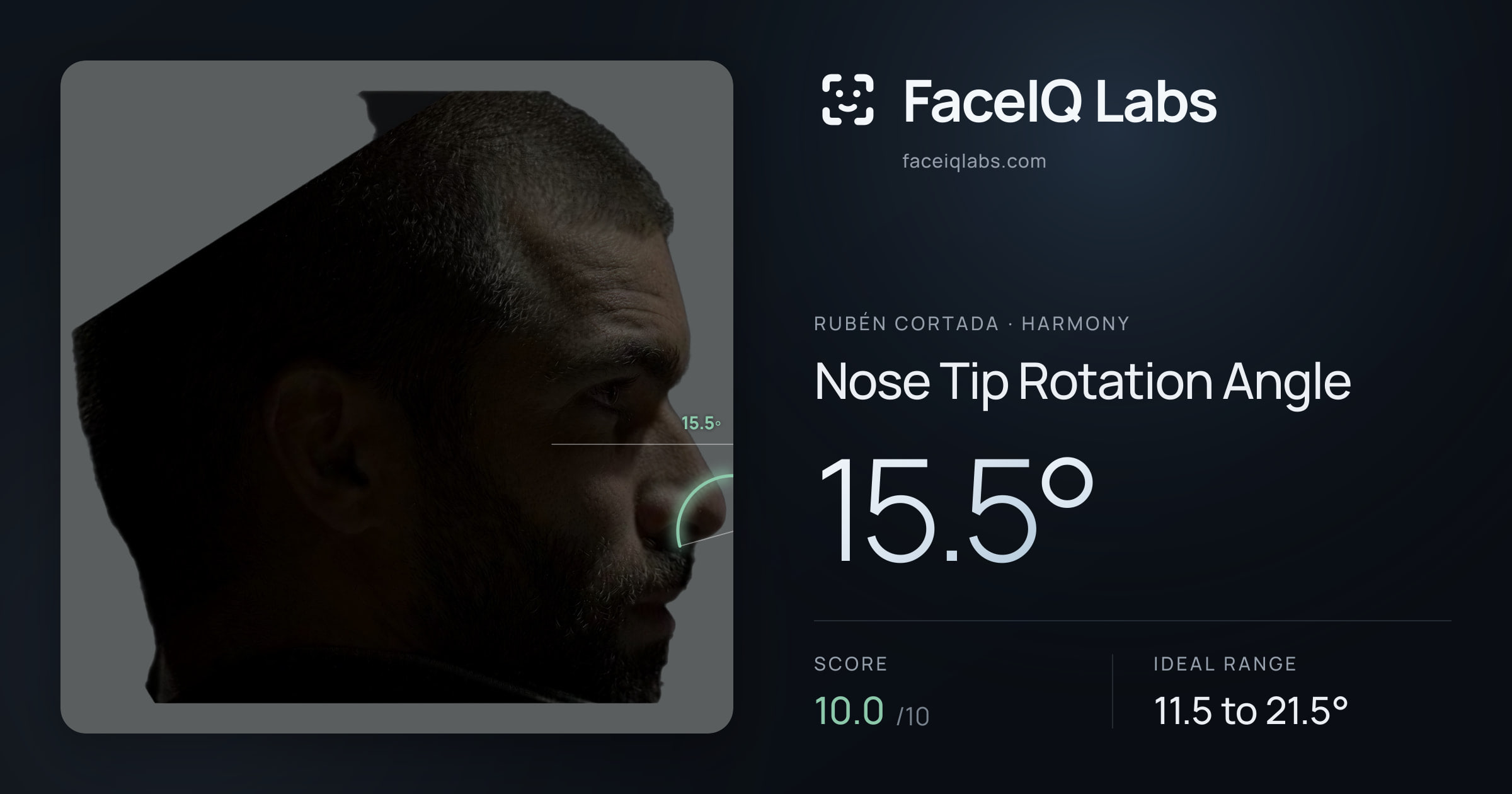 Rubén Cortada Nose Tip Rotation Angle: 15.5°, drawn on the photo