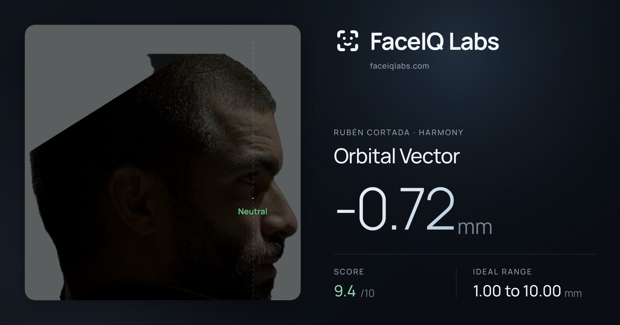 Rubén Cortada Orbital Vector: -0.72mm, drawn on the photo