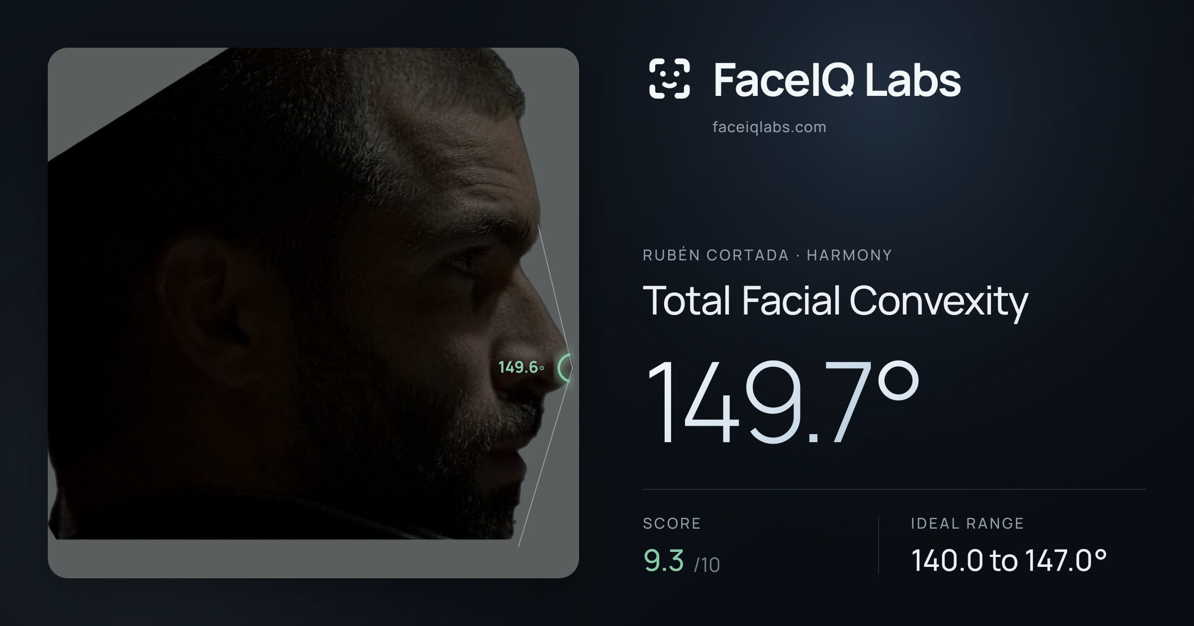 Rubén Cortada Total Facial Convexity: 149.7°, drawn on the photo
