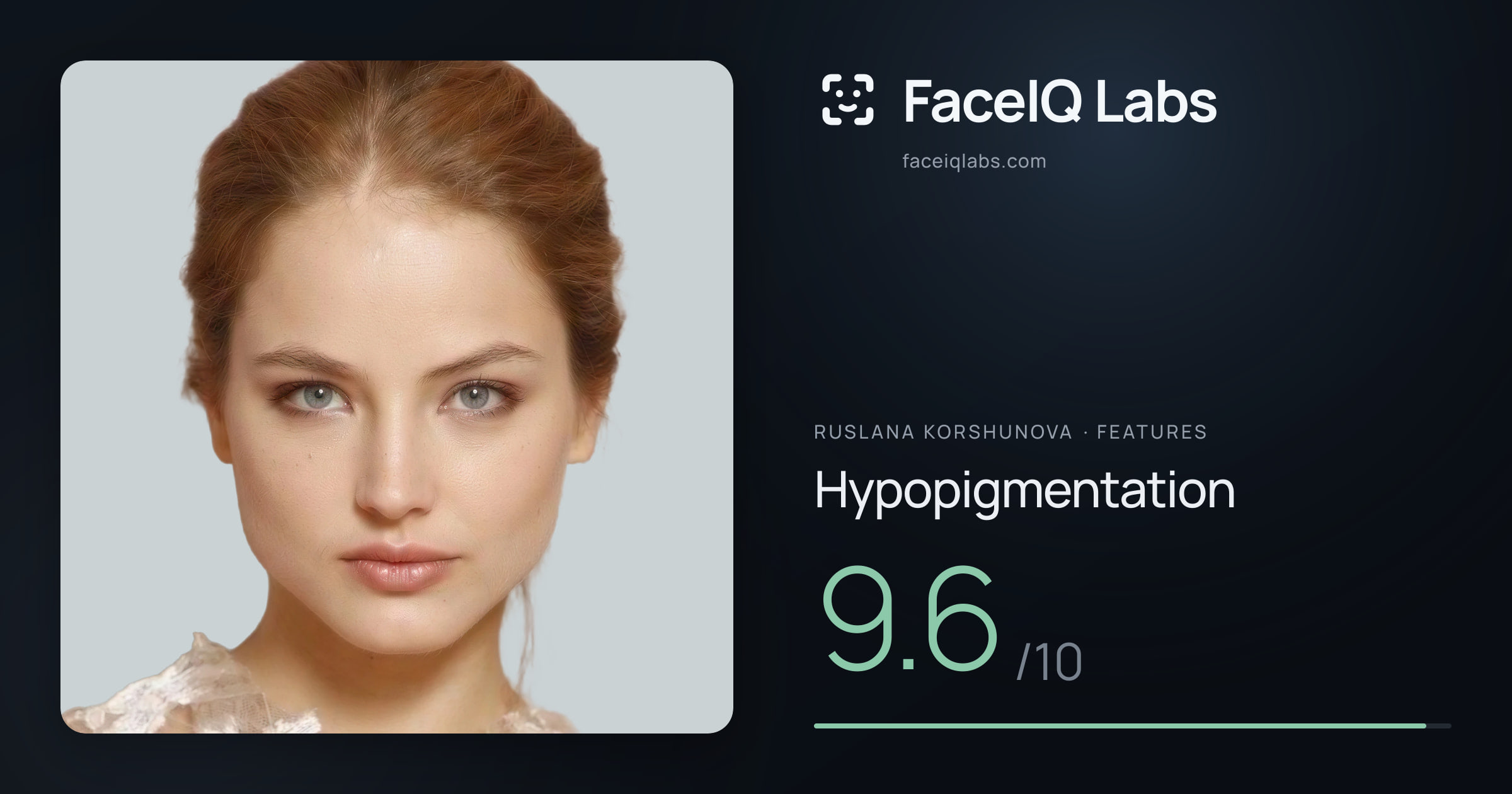 Ruslana Korshunova Hypopigmentation: 9.6/10, drawn on the photo