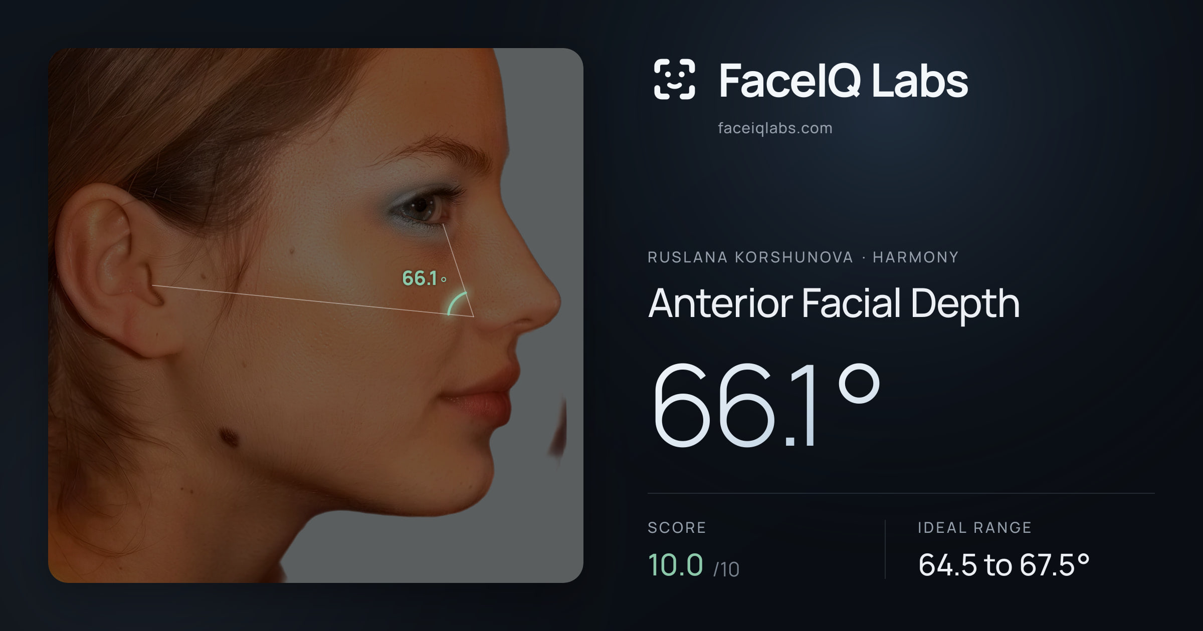Ruslana Korshunova Anterior Facial Depth: 66.1°, drawn on the photo