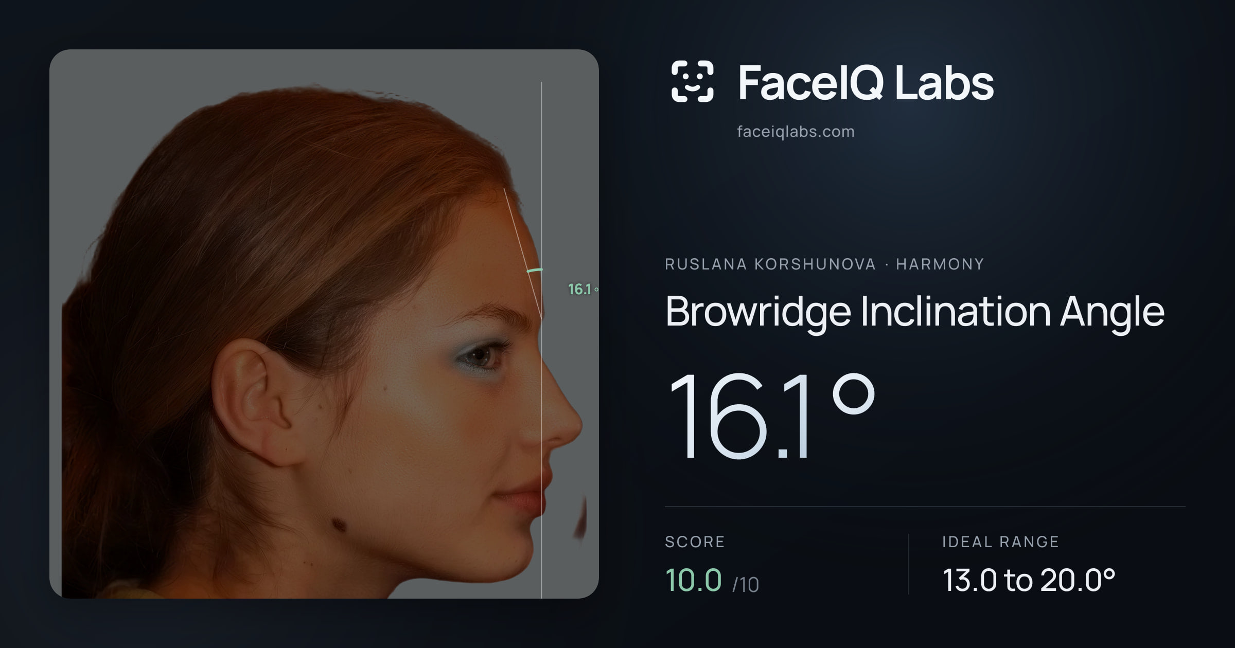 Ruslana Korshunova Browridge Inclination Angle: 16.1°, drawn on the photo
