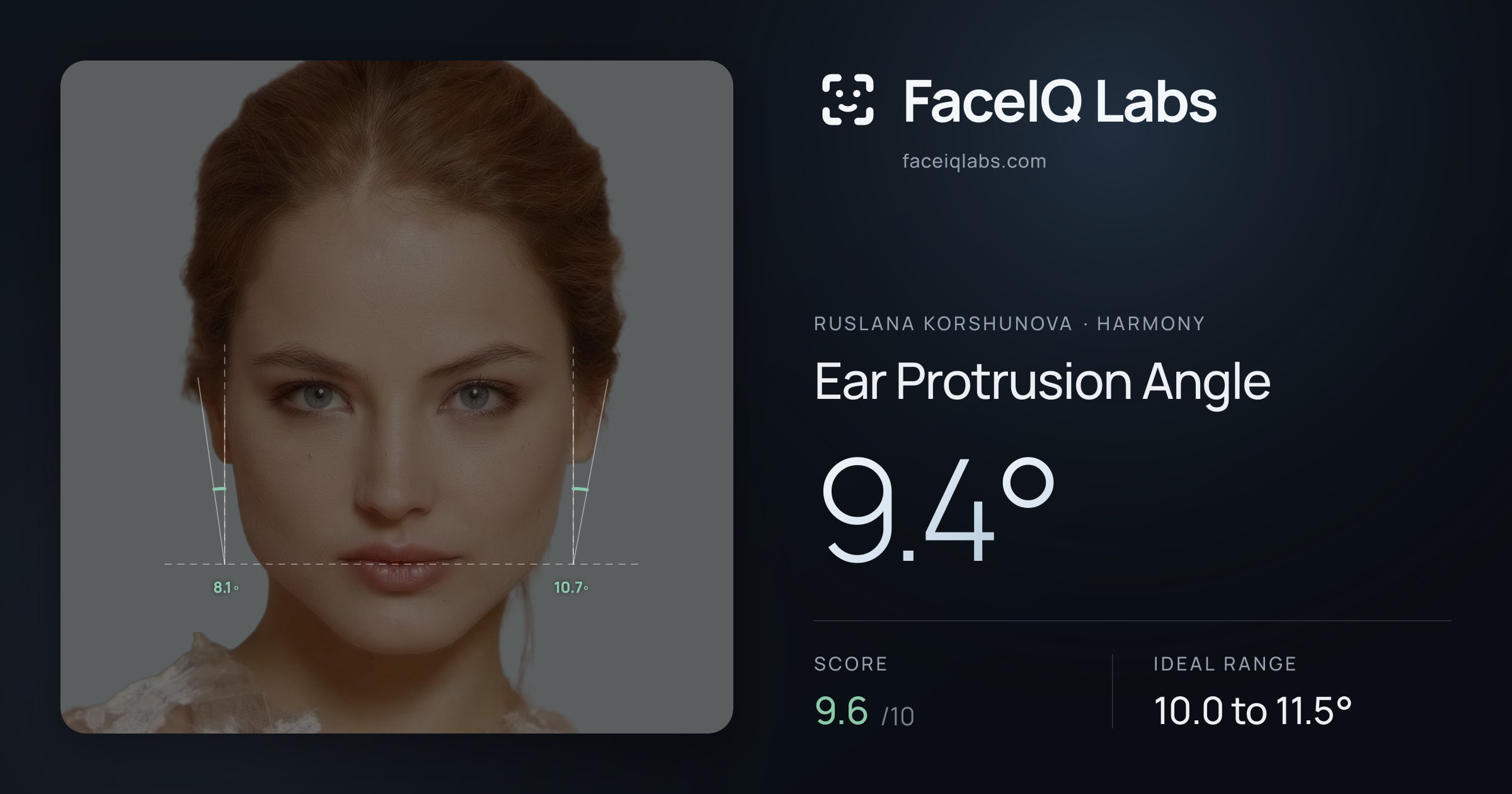 Ruslana Korshunova Ear Protrusion Angle: 9.4°, drawn on the photo