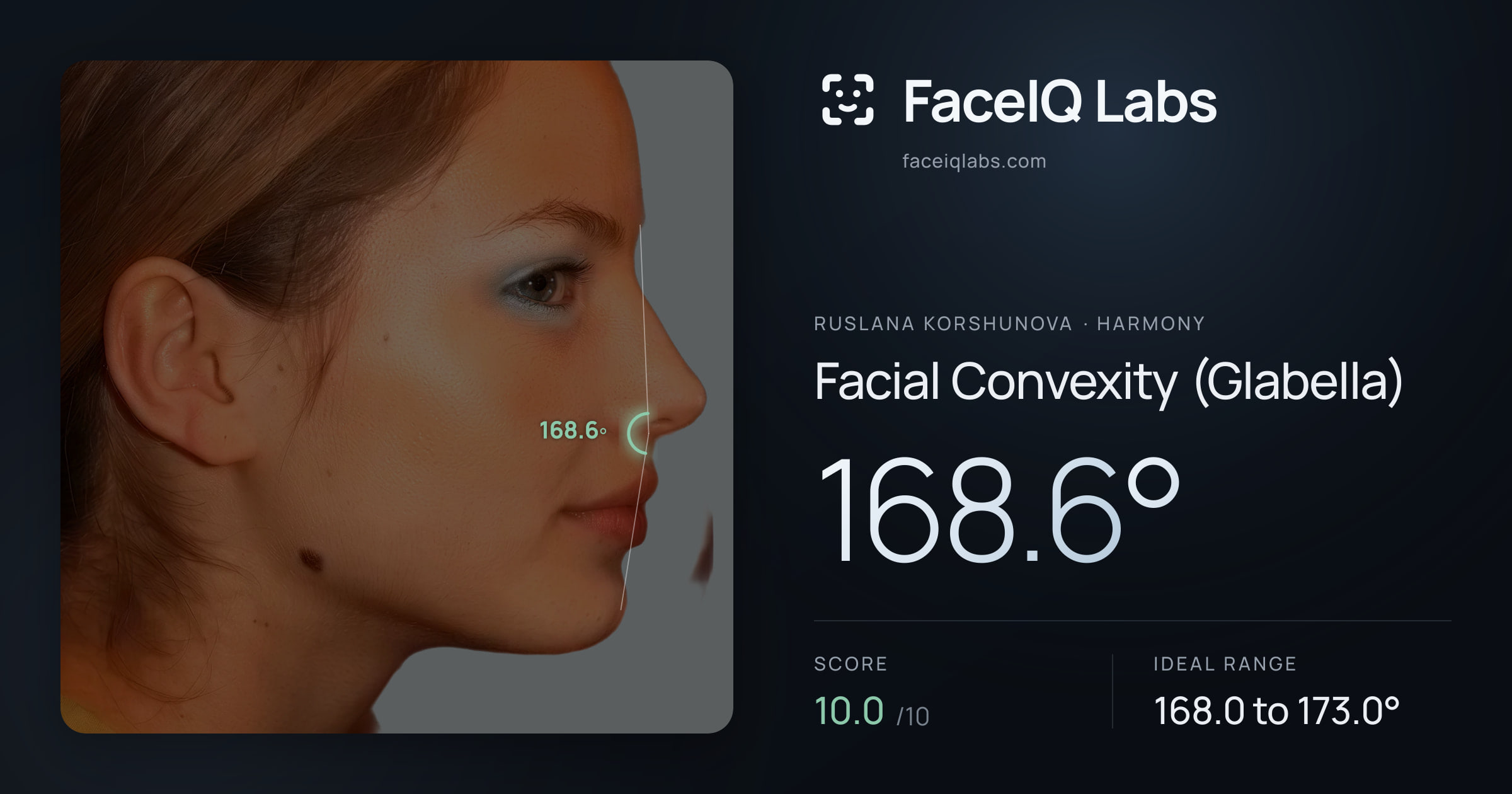 Ruslana Korshunova Facial Convexity (Glabella): 168.6°, drawn on the photo