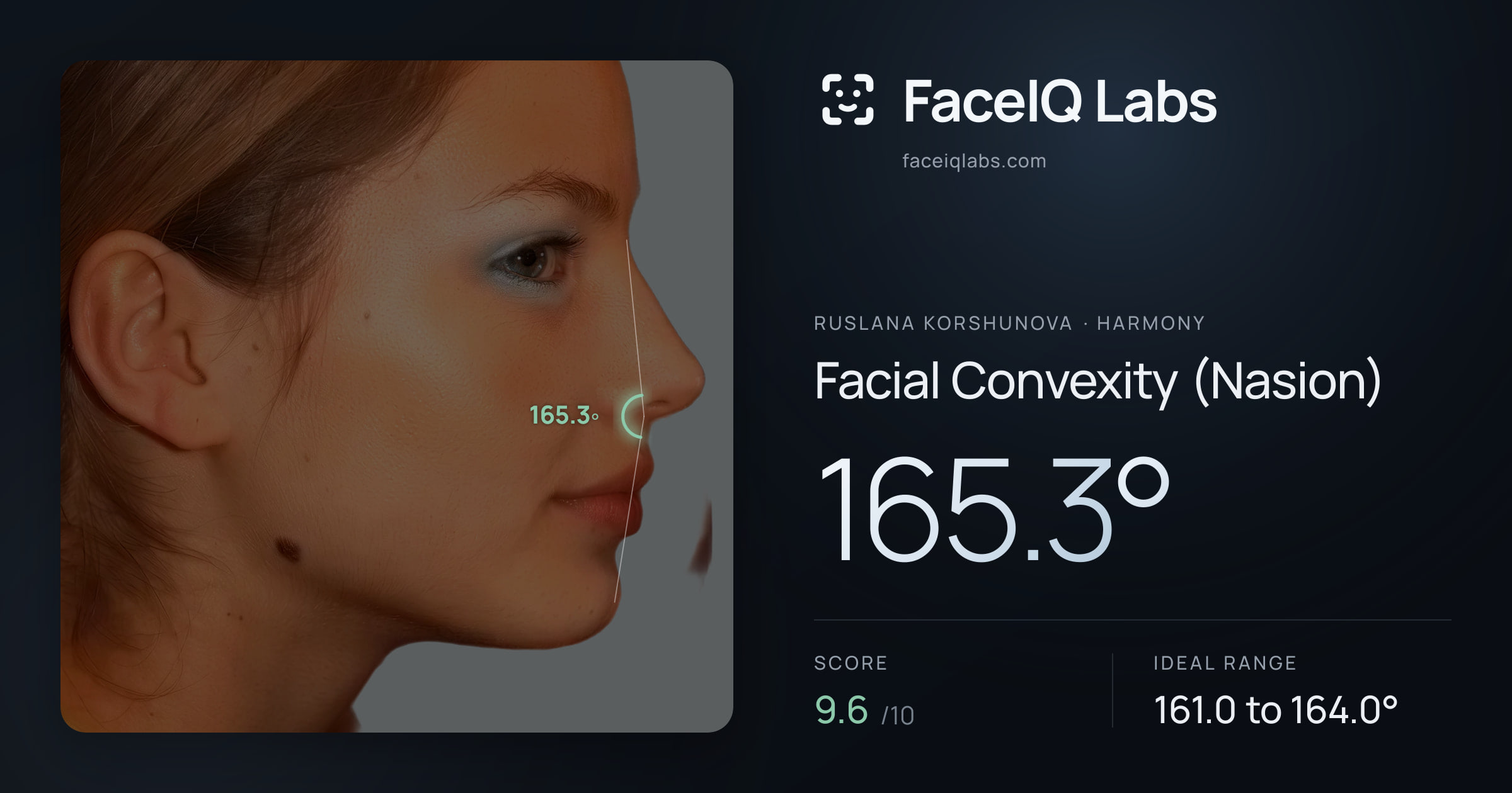 Ruslana Korshunova Facial Convexity (Nasion): 165.3°, drawn on the photo