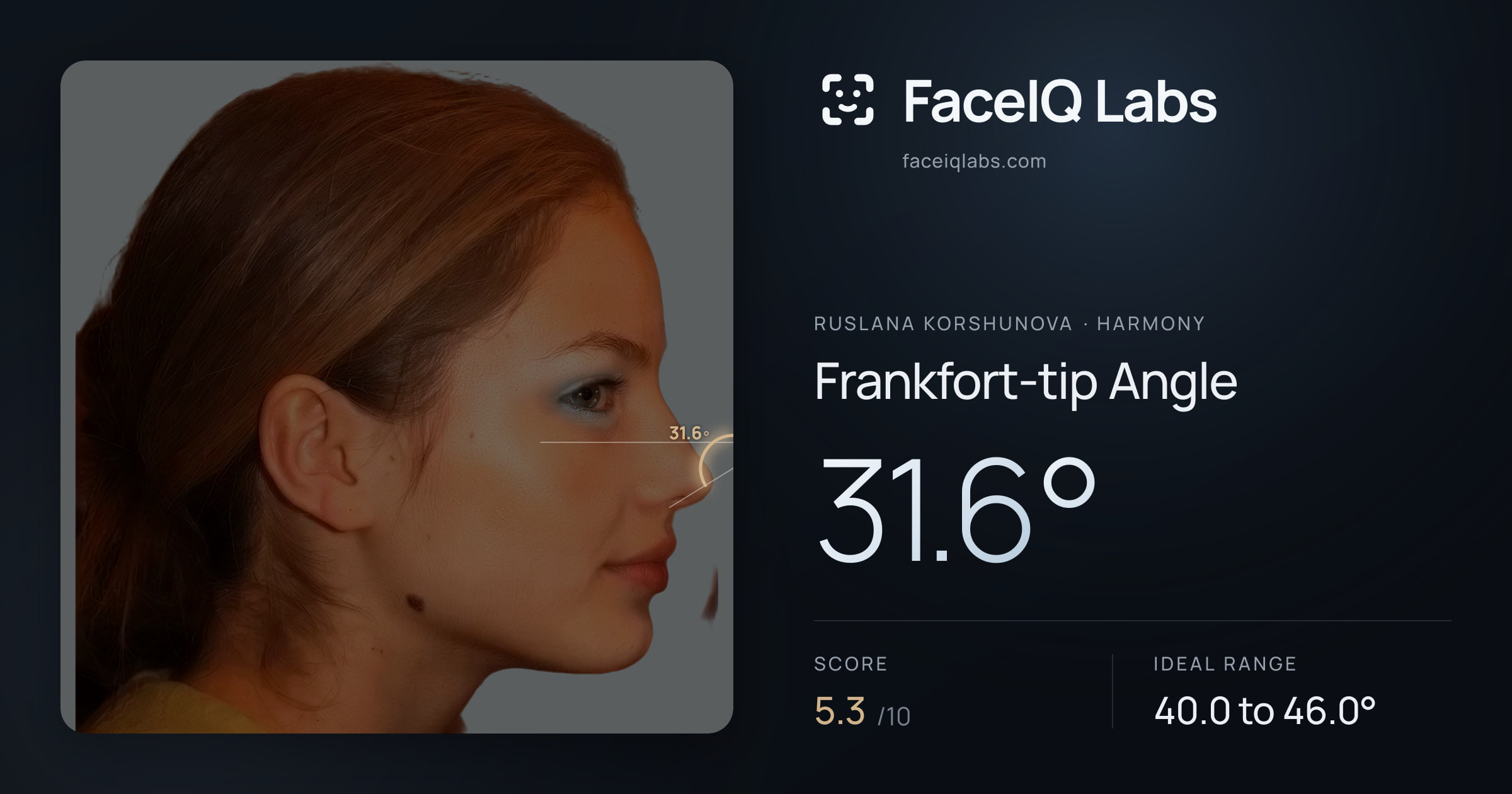 Ruslana Korshunova Frankfort-tip Angle: 31.6°, drawn on the photo