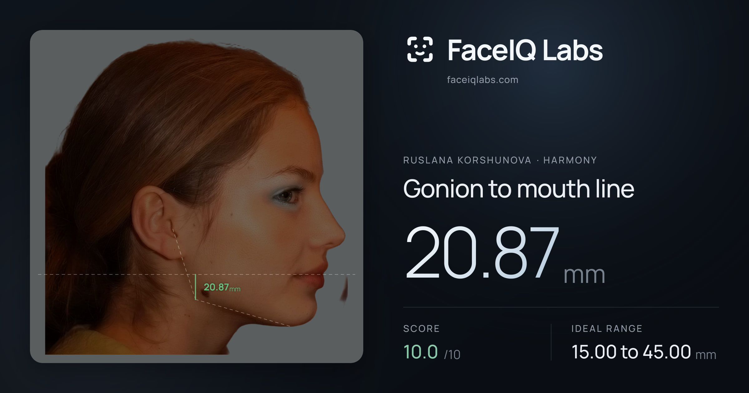 Ruslana Korshunova Gonion to mouth line: 20.87mm, drawn on the photo