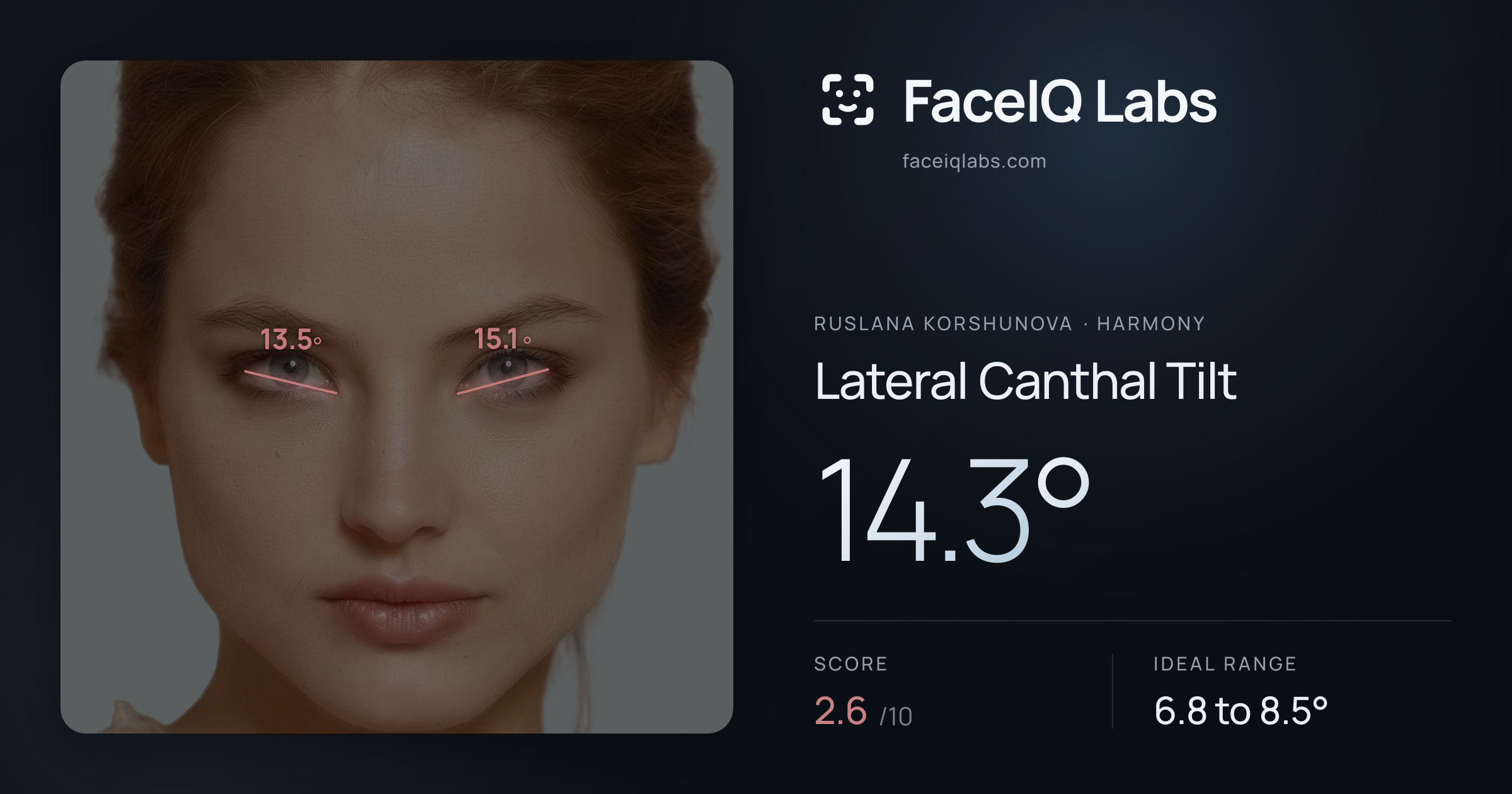 Ruslana Korshunova Lateral Canthal Tilt: 14.3°, drawn on the photo