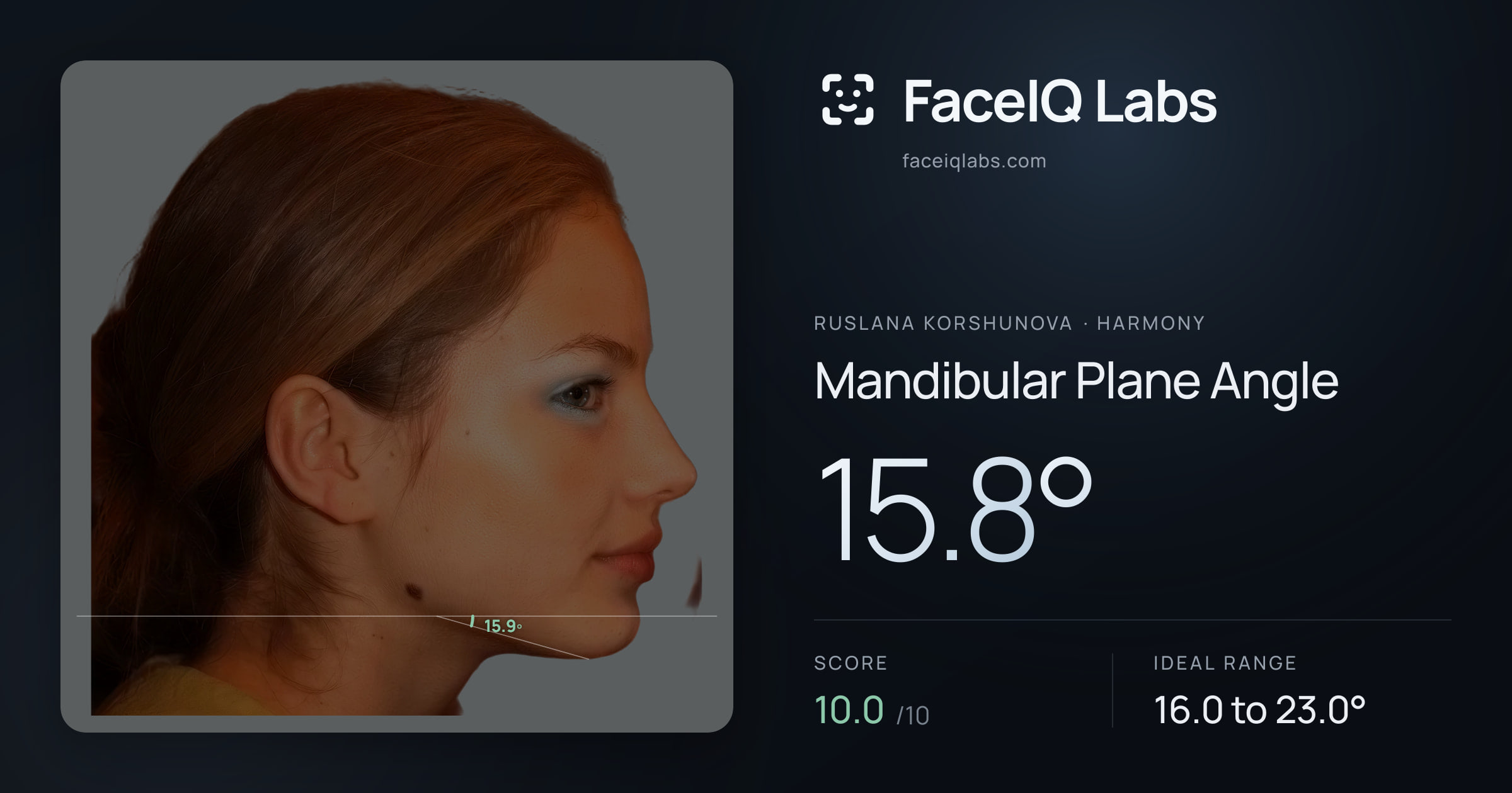 Ruslana Korshunova Mandibular Plane Angle: 15.8°, drawn on the photo
