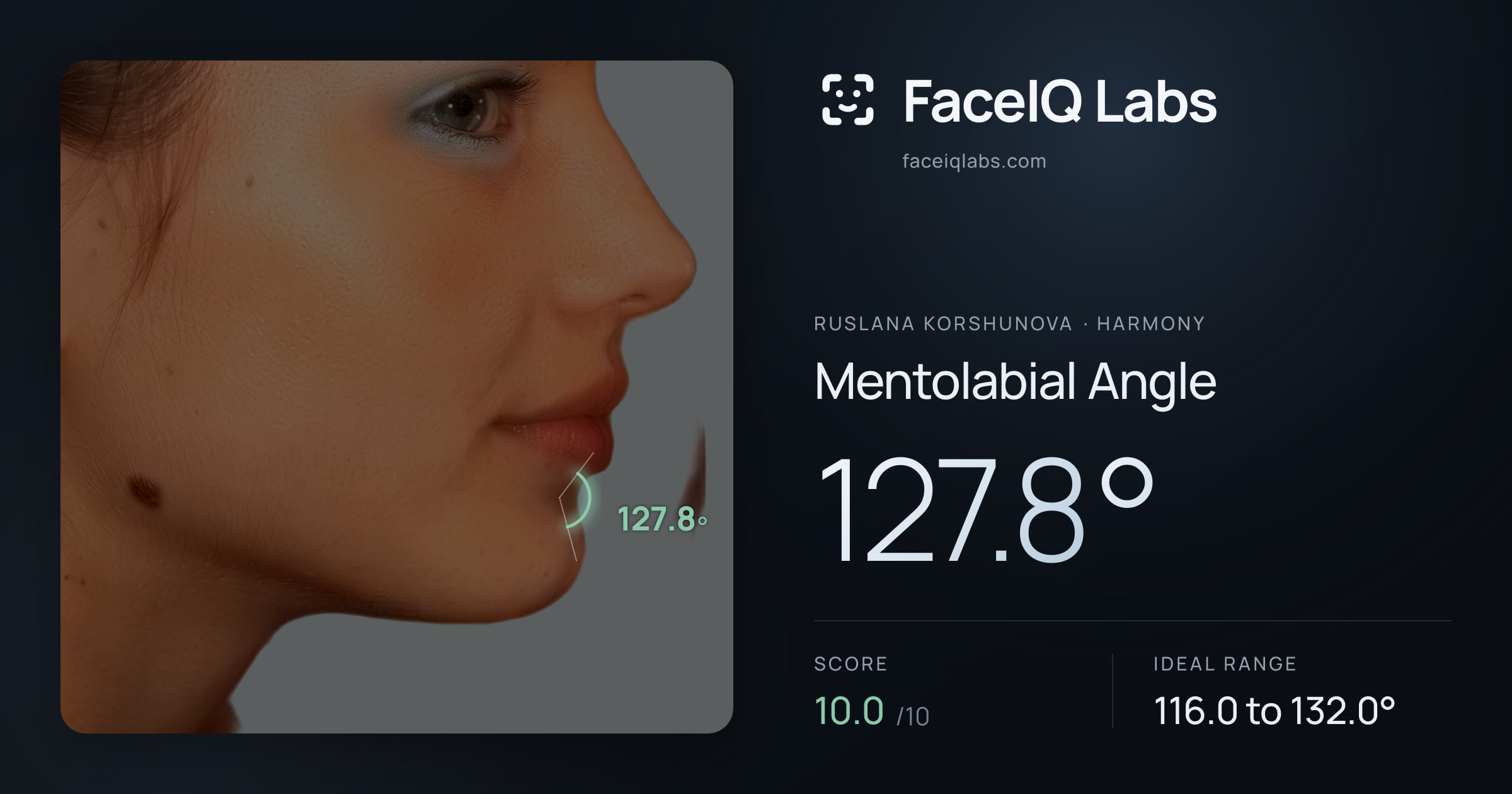 Ruslana Korshunova Mentolabial Angle: 127.8°, drawn on the photo