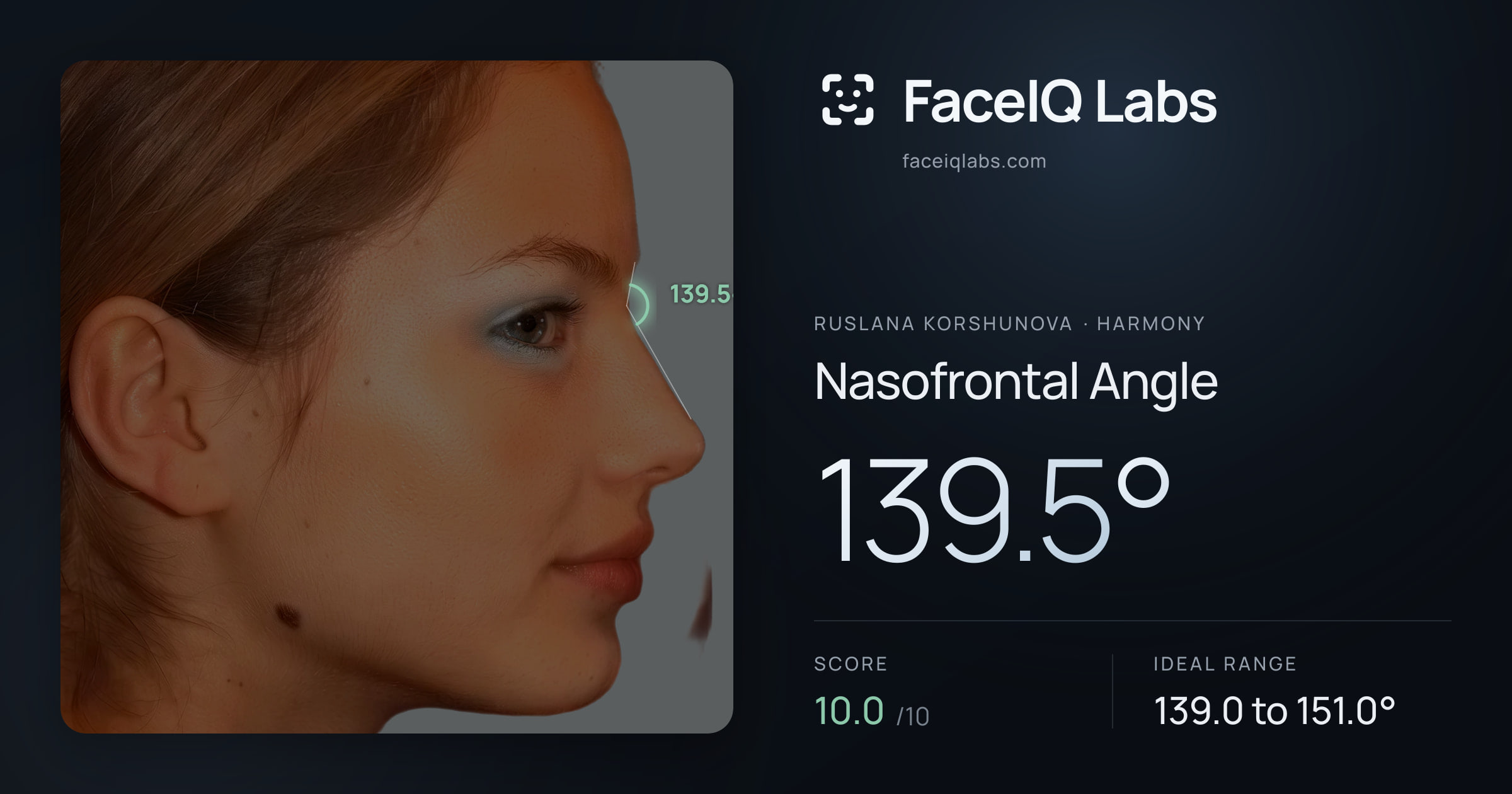 Ruslana Korshunova Nasofrontal Angle: 139.5°, drawn on the photo