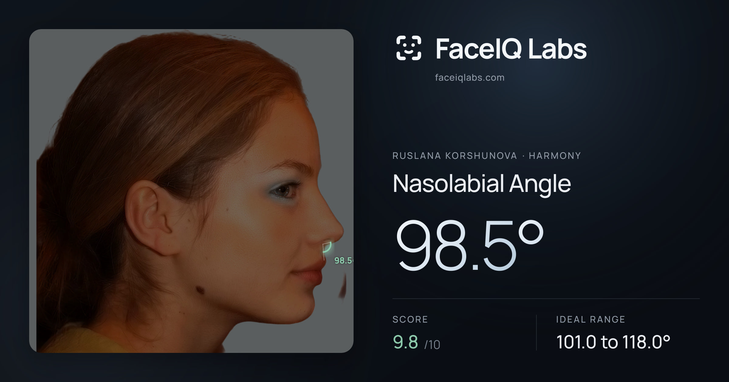 Ruslana Korshunova Nasolabial Angle: 98.5°, drawn on the photo