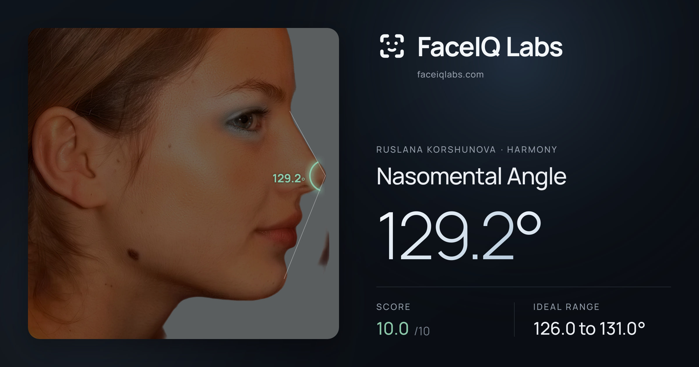 Ruslana Korshunova Nasomental Angle: 129.2°, drawn on the photo