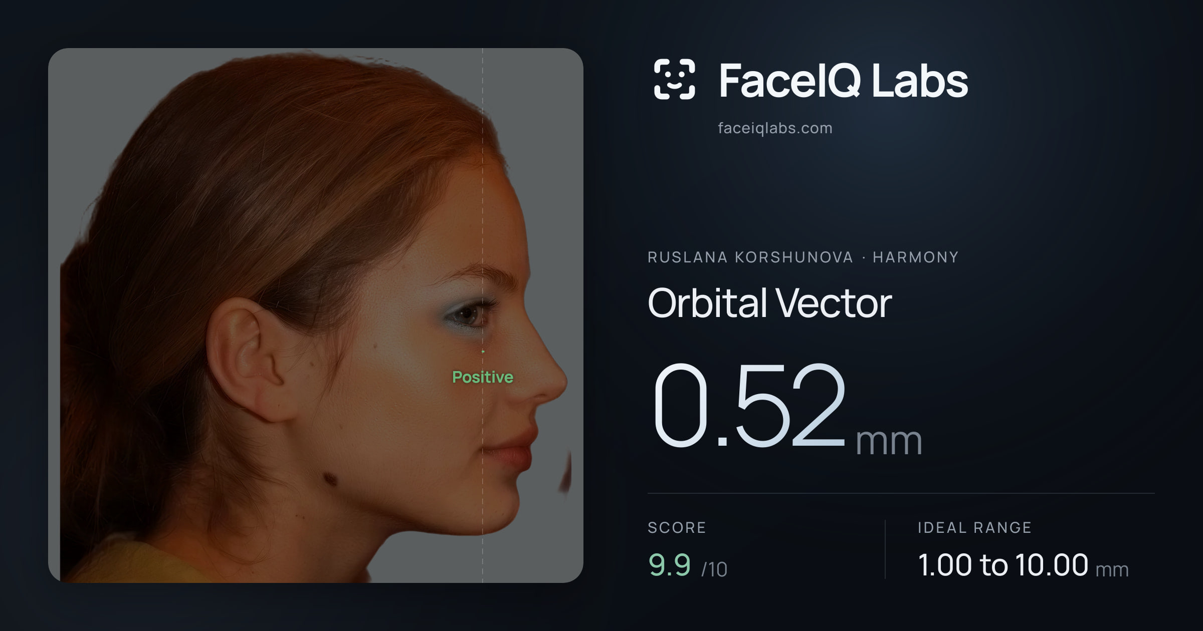 Ruslana Korshunova Orbital Vector: 0.52mm, drawn on the photo