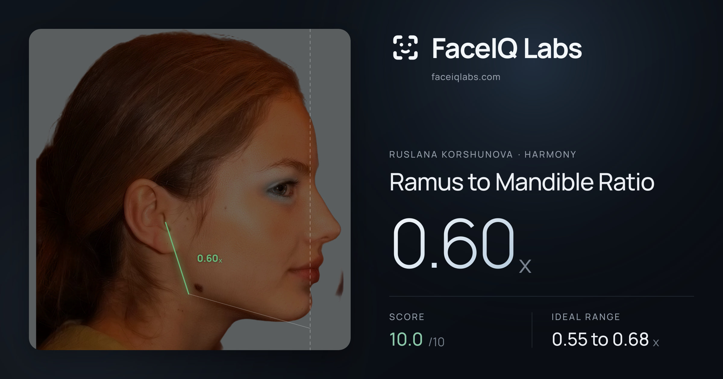 Ruslana Korshunova Ramus to Mandible Ratio: 0.60x, drawn on the photo