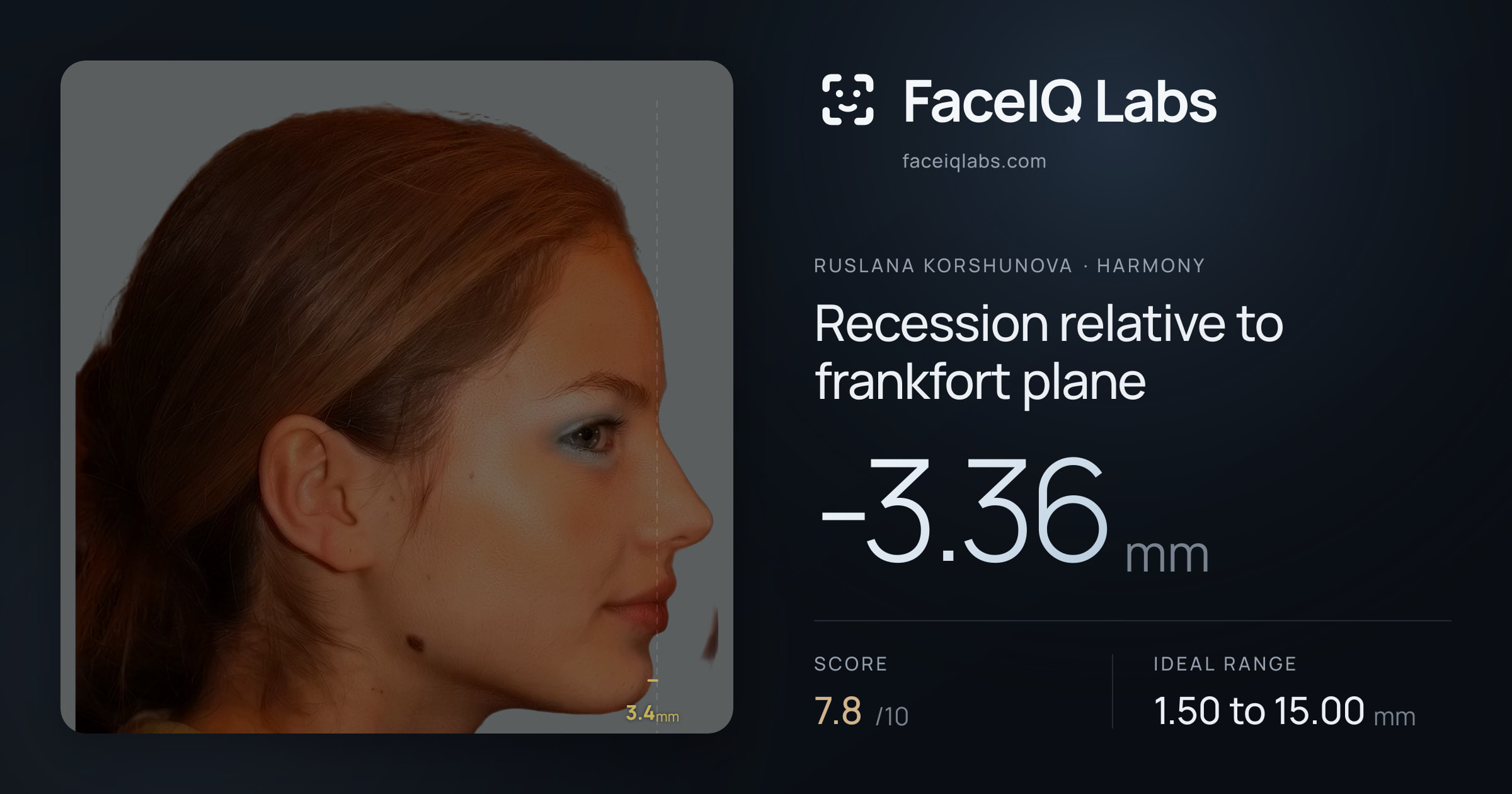 Ruslana Korshunova Recession relative to frankfort plane: -3.36mm, drawn on the photo