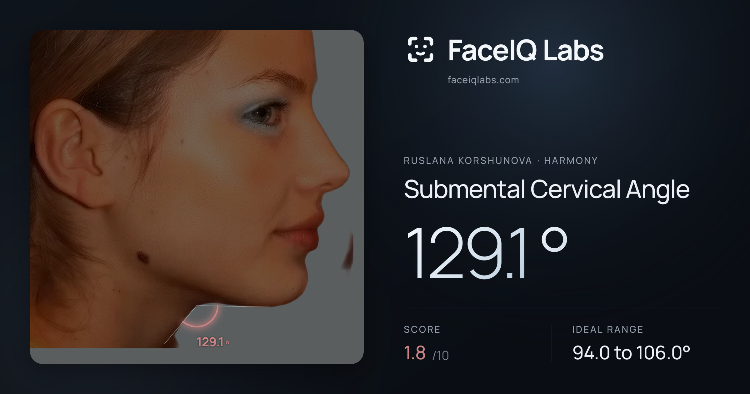 Ruslana Korshunova Submental Cervical Angle: 129.1°, drawn on the photo