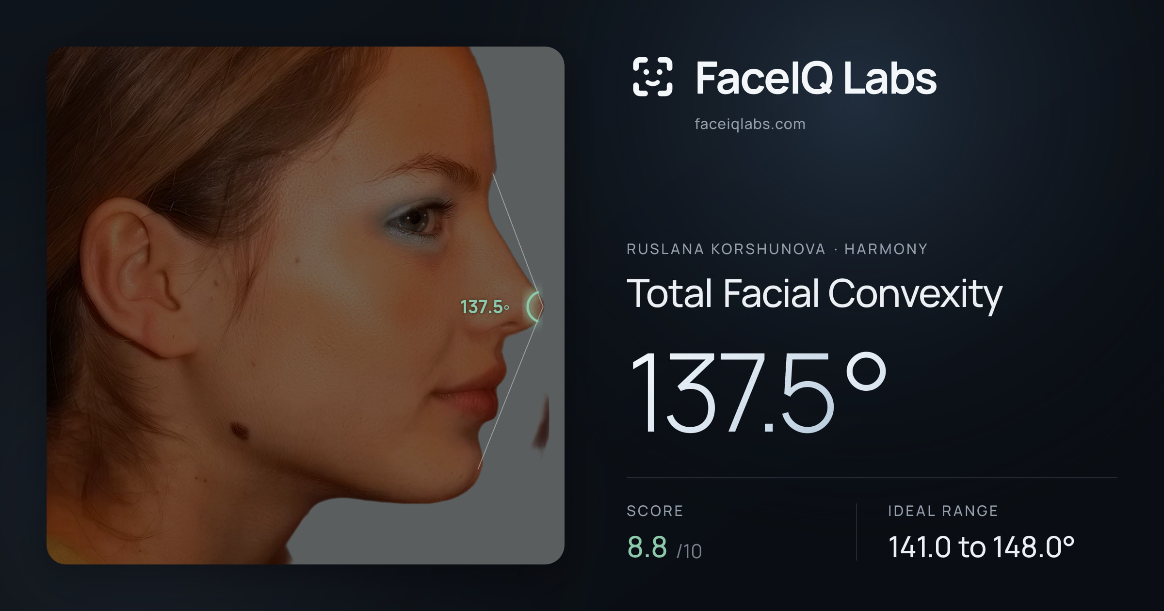 Ruslana Korshunova Total Facial Convexity: 137.5°, drawn on the photo