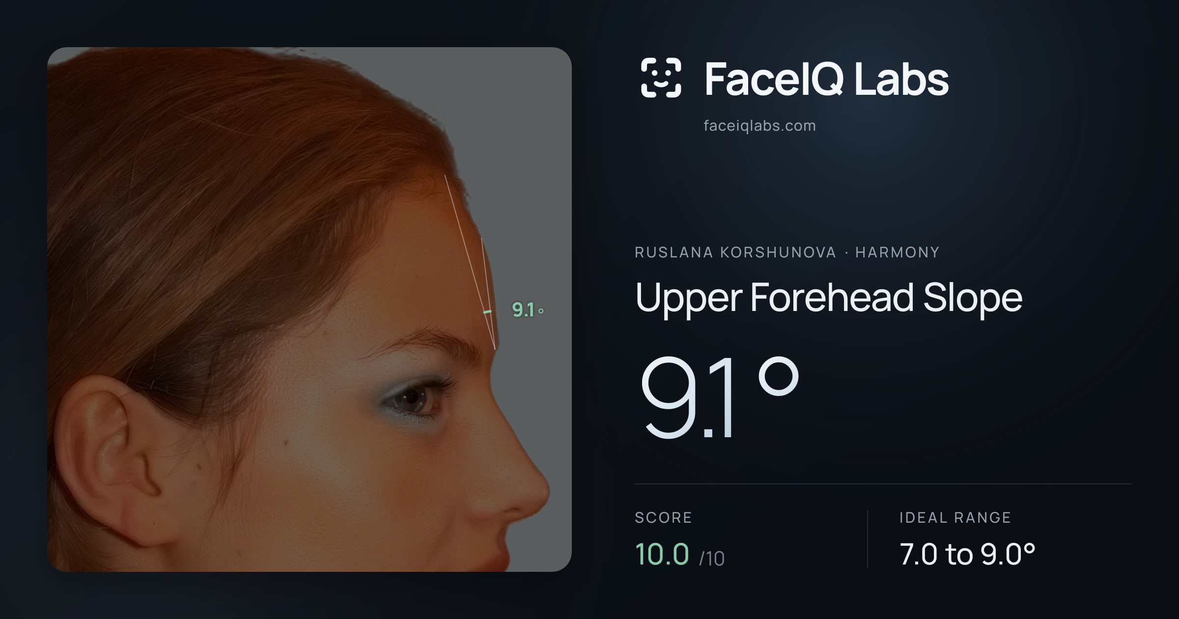 Ruslana Korshunova Upper Forehead Slope: 9.1°, drawn on the photo