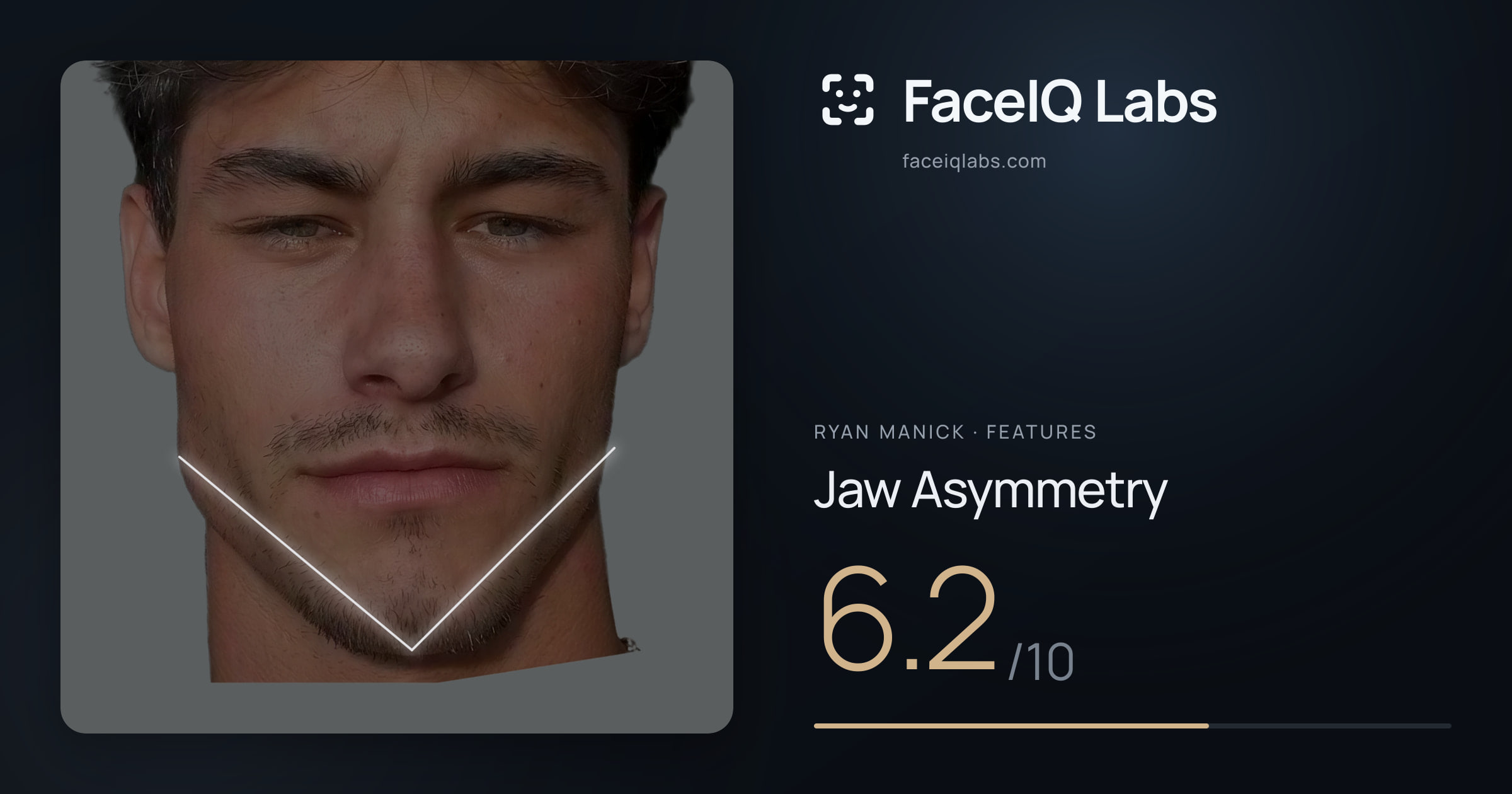 Ryan Manick Jaw Asymmetry: 6.2/10, drawn on the photo