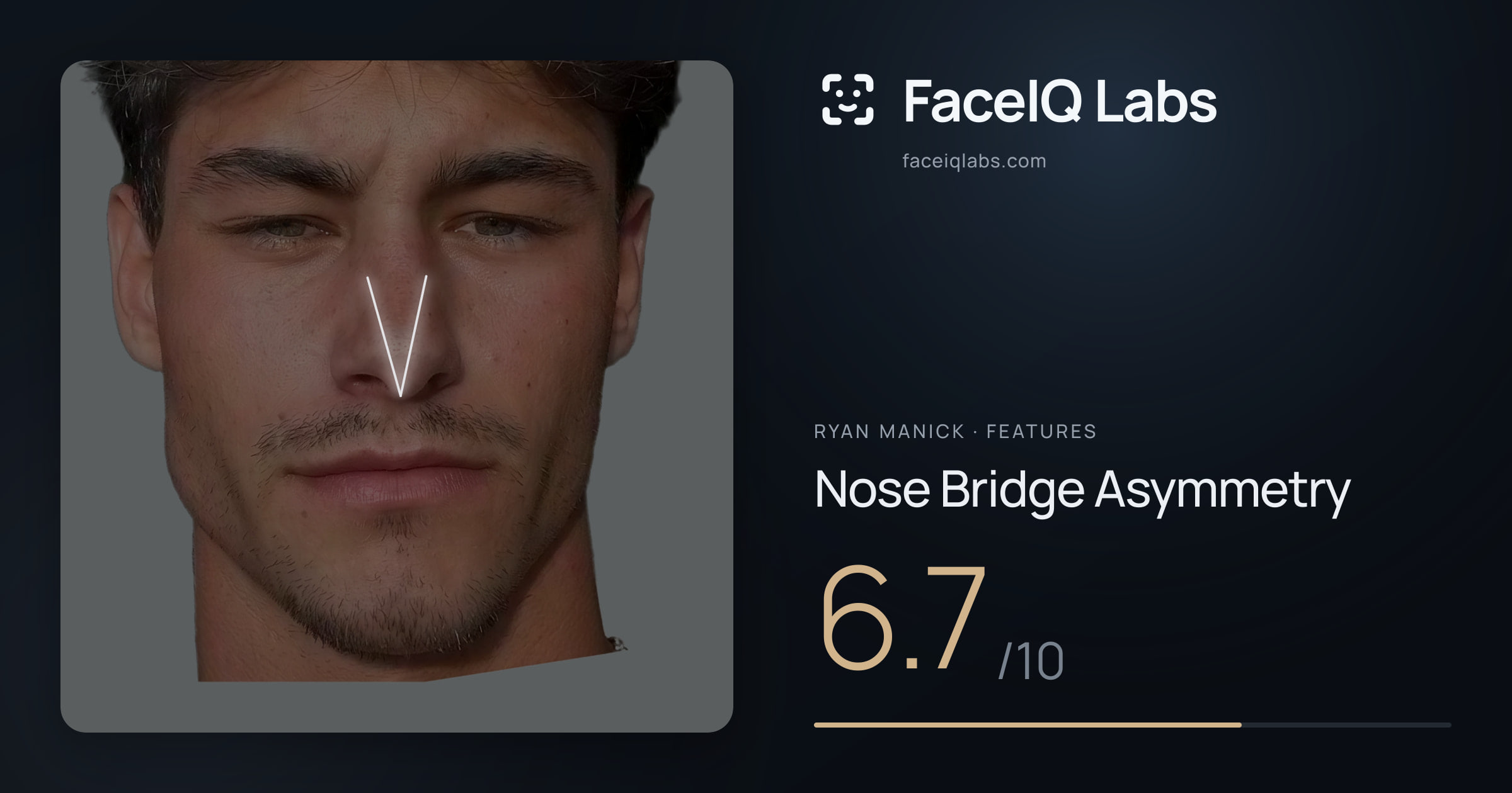 Ryan Manick Nose Bridge Asymmetry: 6.7/10, drawn on the photo