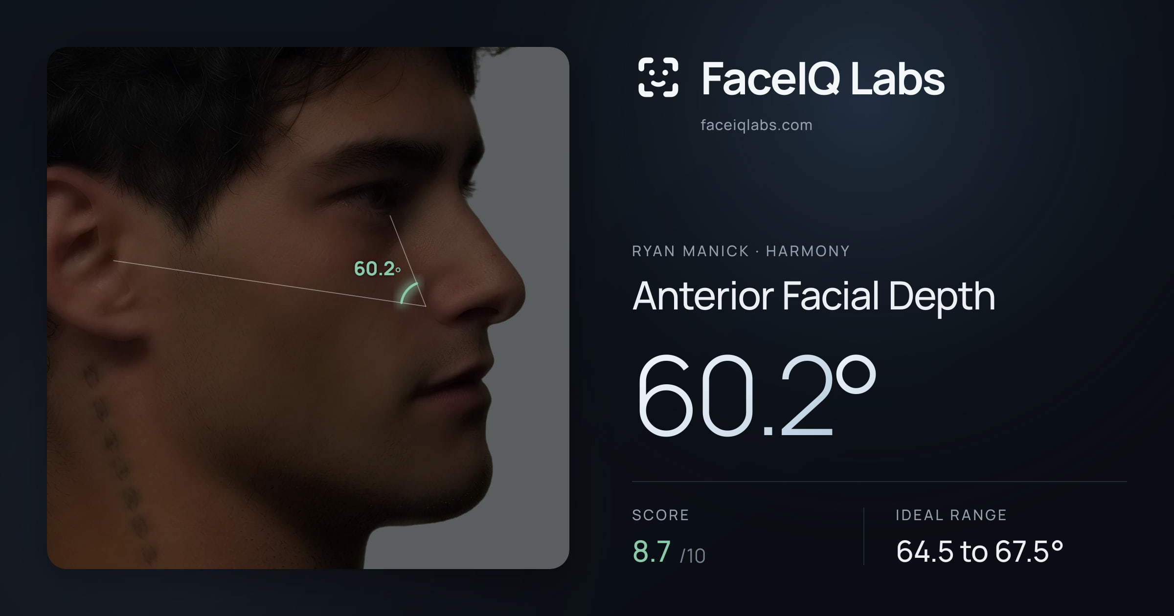 Ryan Manick Anterior Facial Depth: 60.2°, drawn on the photo
