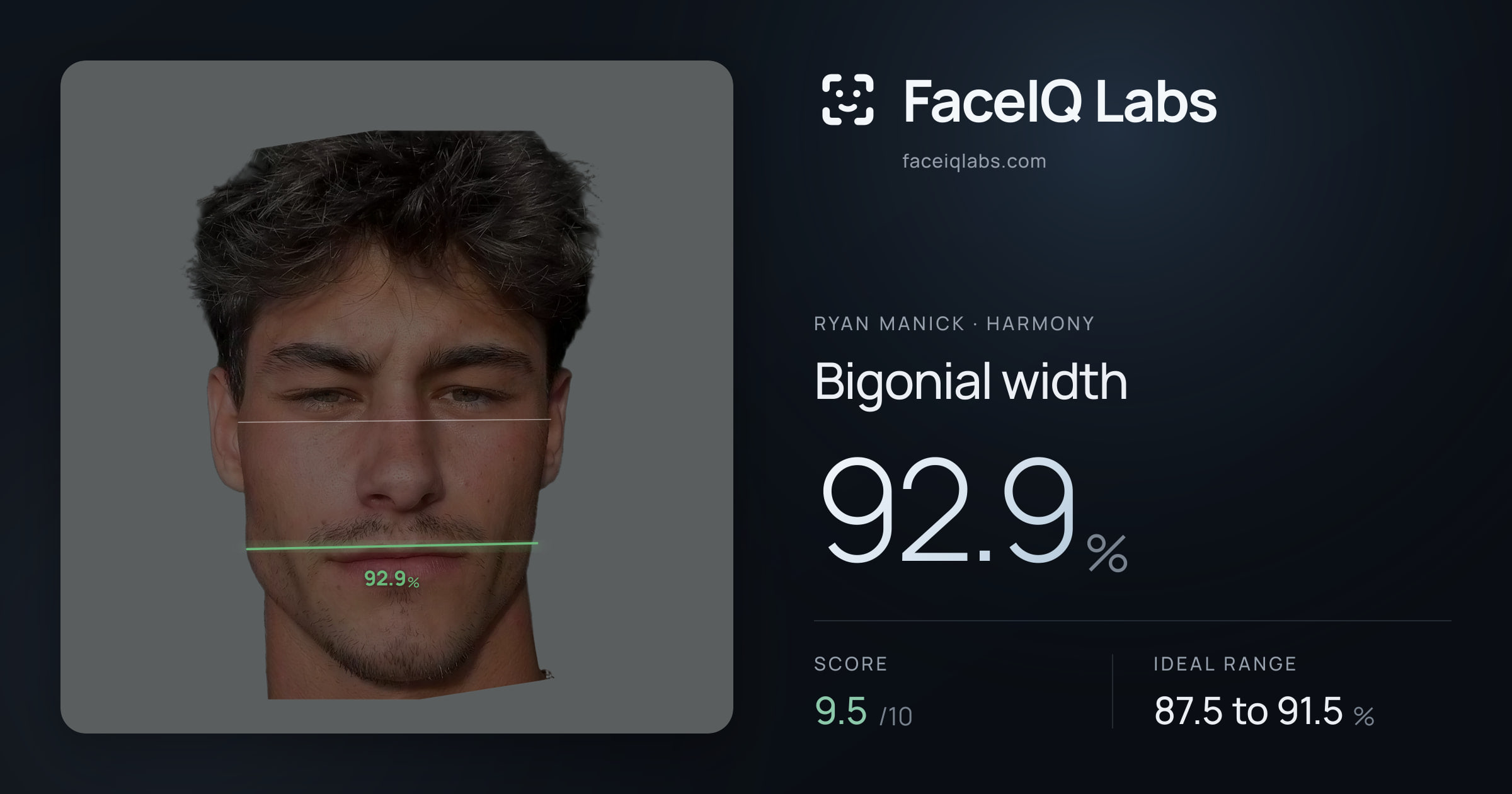 Ryan Manick Bigonial width: 92.9%, drawn on the photo