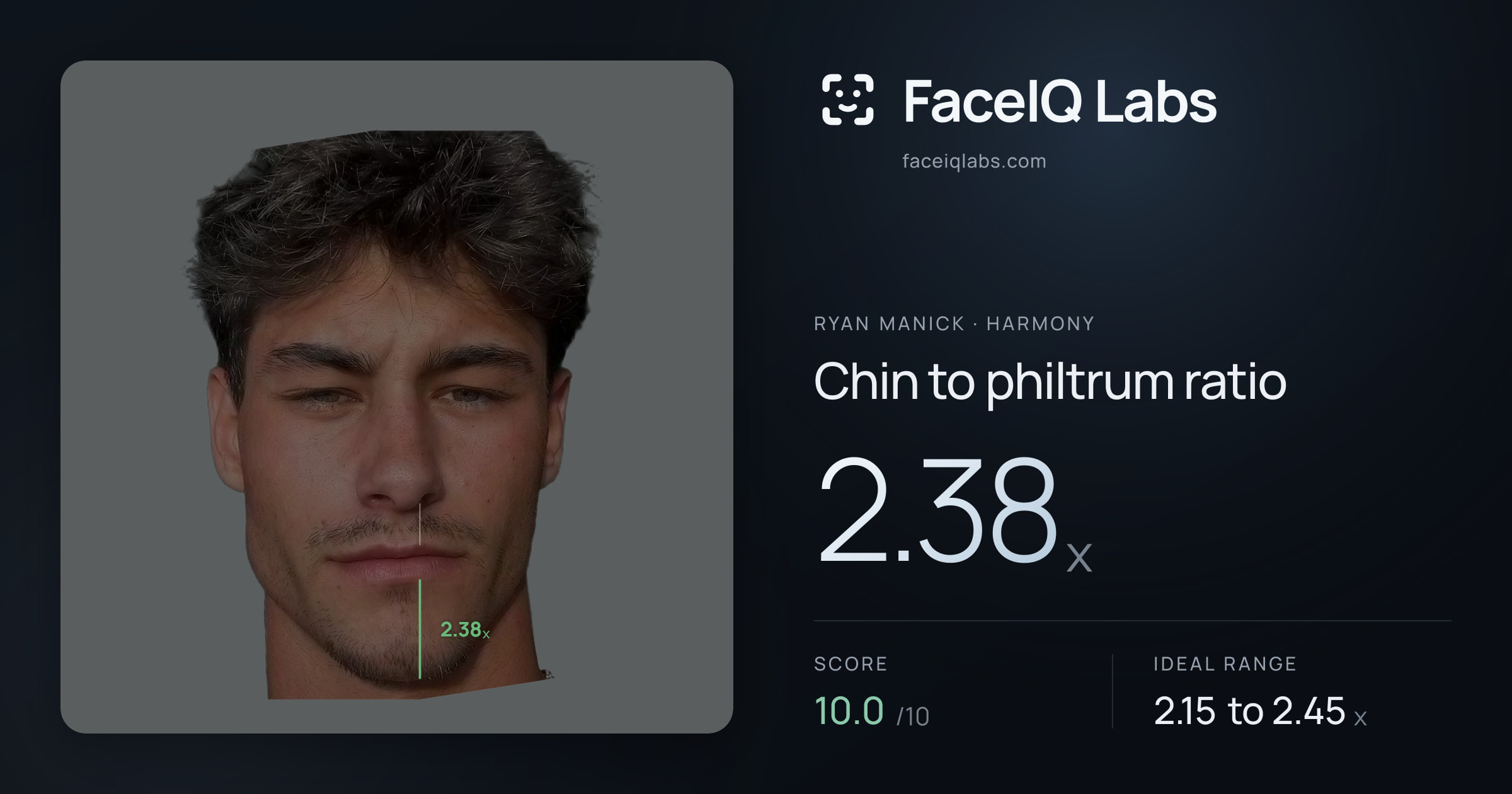 Ryan Manick Chin to philtrum ratio: 2.38x, drawn on the photo