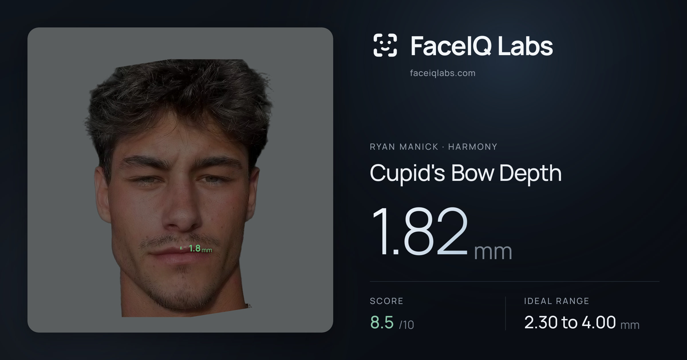 Ryan Manick Cupid's Bow Depth: 1.82mm, drawn on the photo