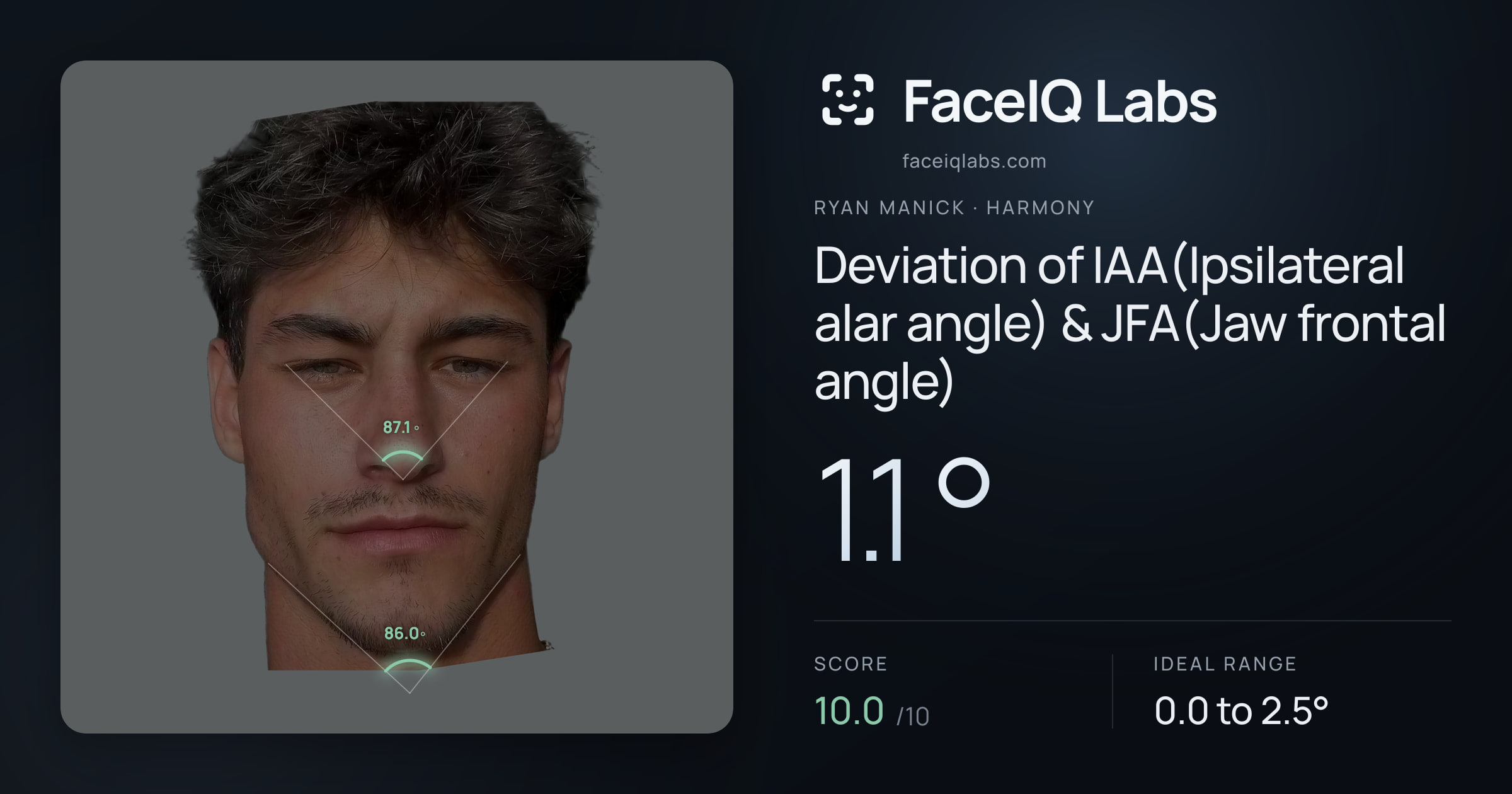 Ryan Manick Deviation of IAA(Ipsilateral alar angle) & JFA(Jaw frontal angle): 1.1°, drawn on the photo