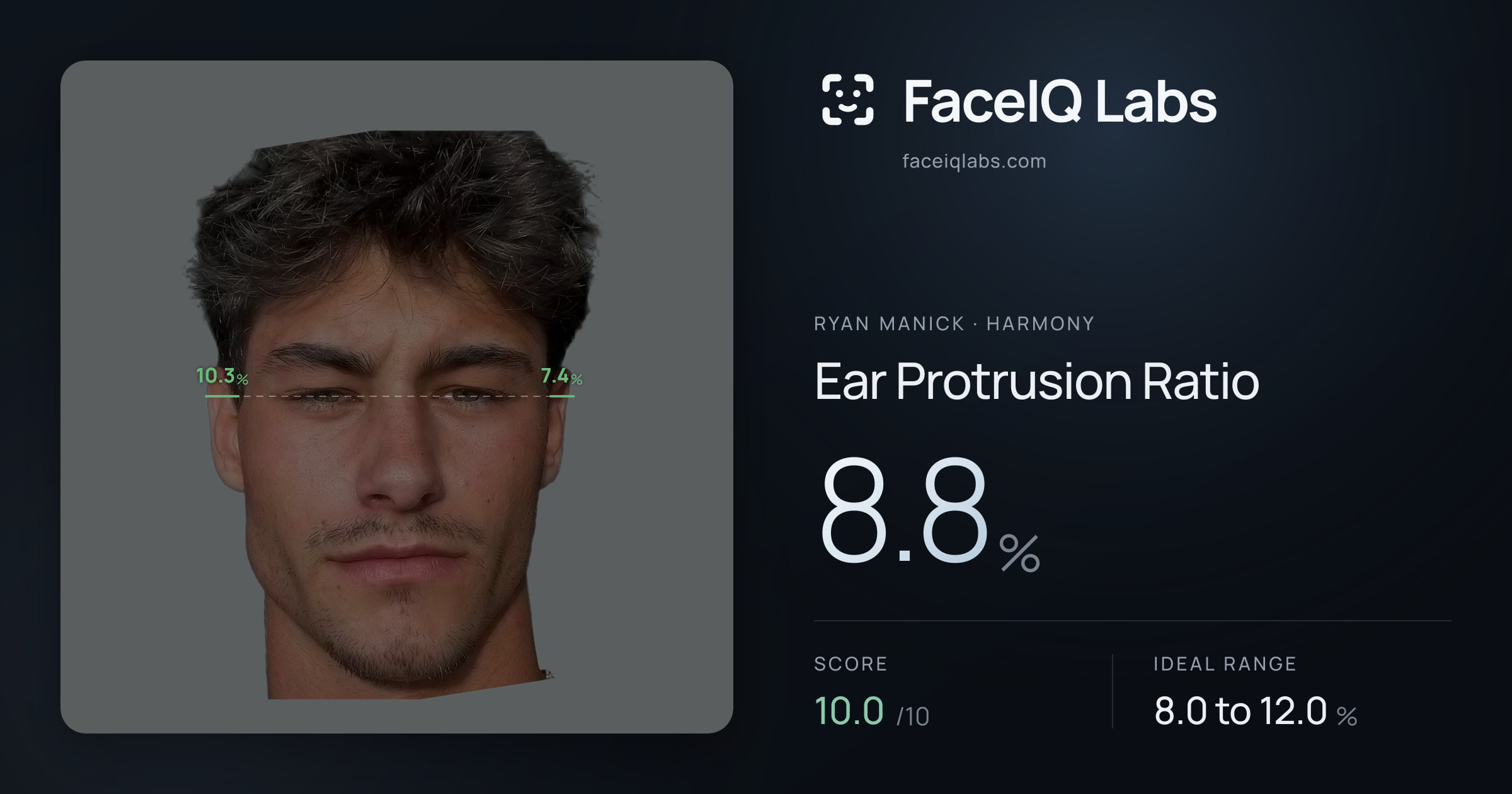 Ryan Manick Ear Protrusion Ratio: 8.8%, drawn on the photo