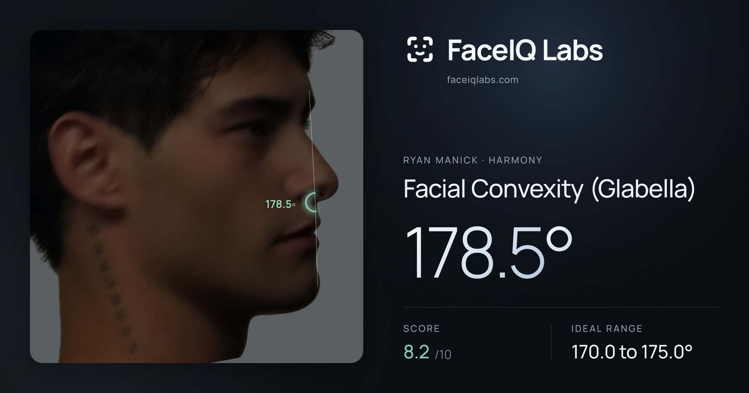 Ryan Manick Facial Convexity (Glabella): 178.5°, drawn on the photo