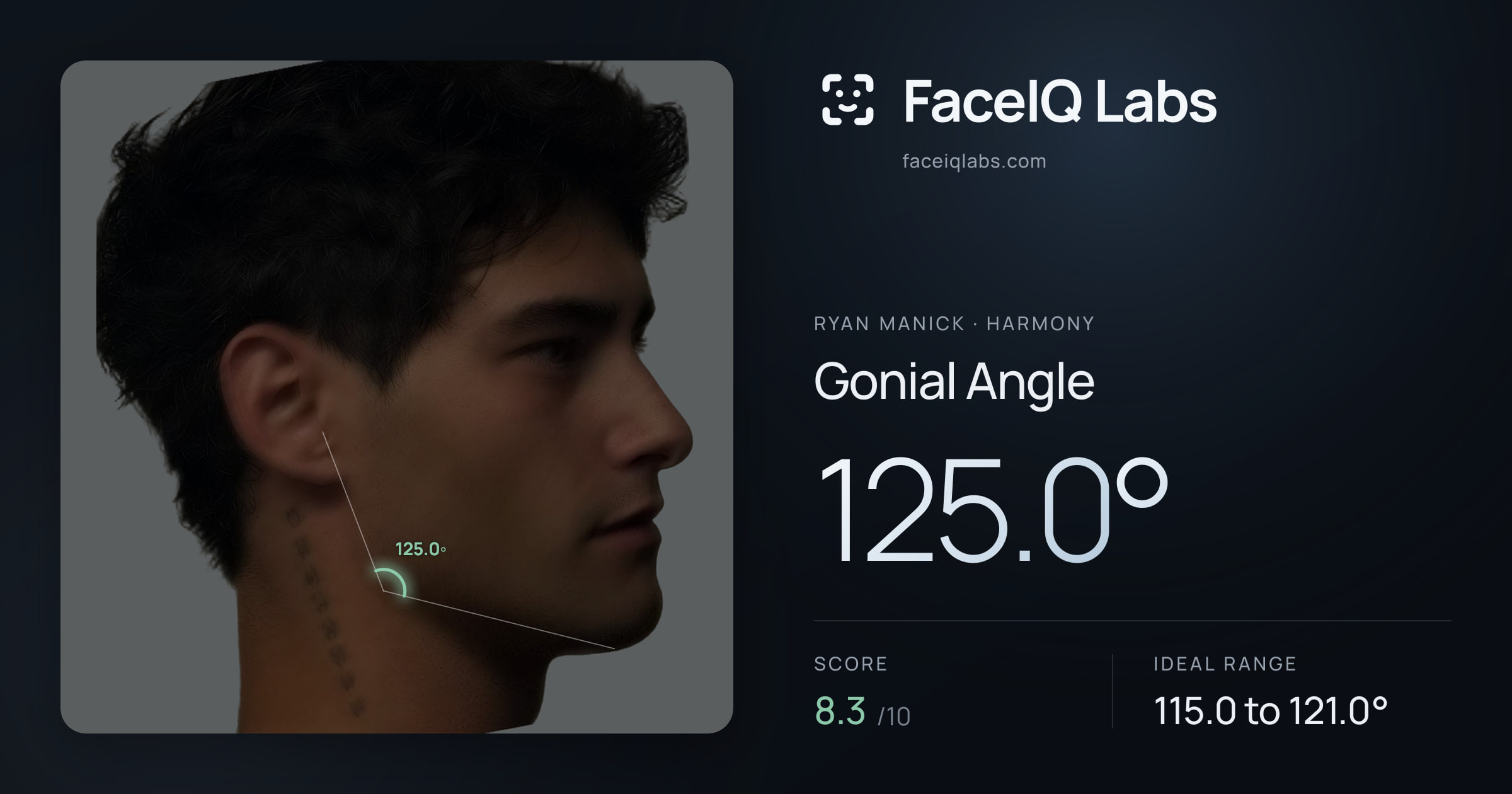 Ryan Manick Gonial Angle: 125.0°, drawn on the photo