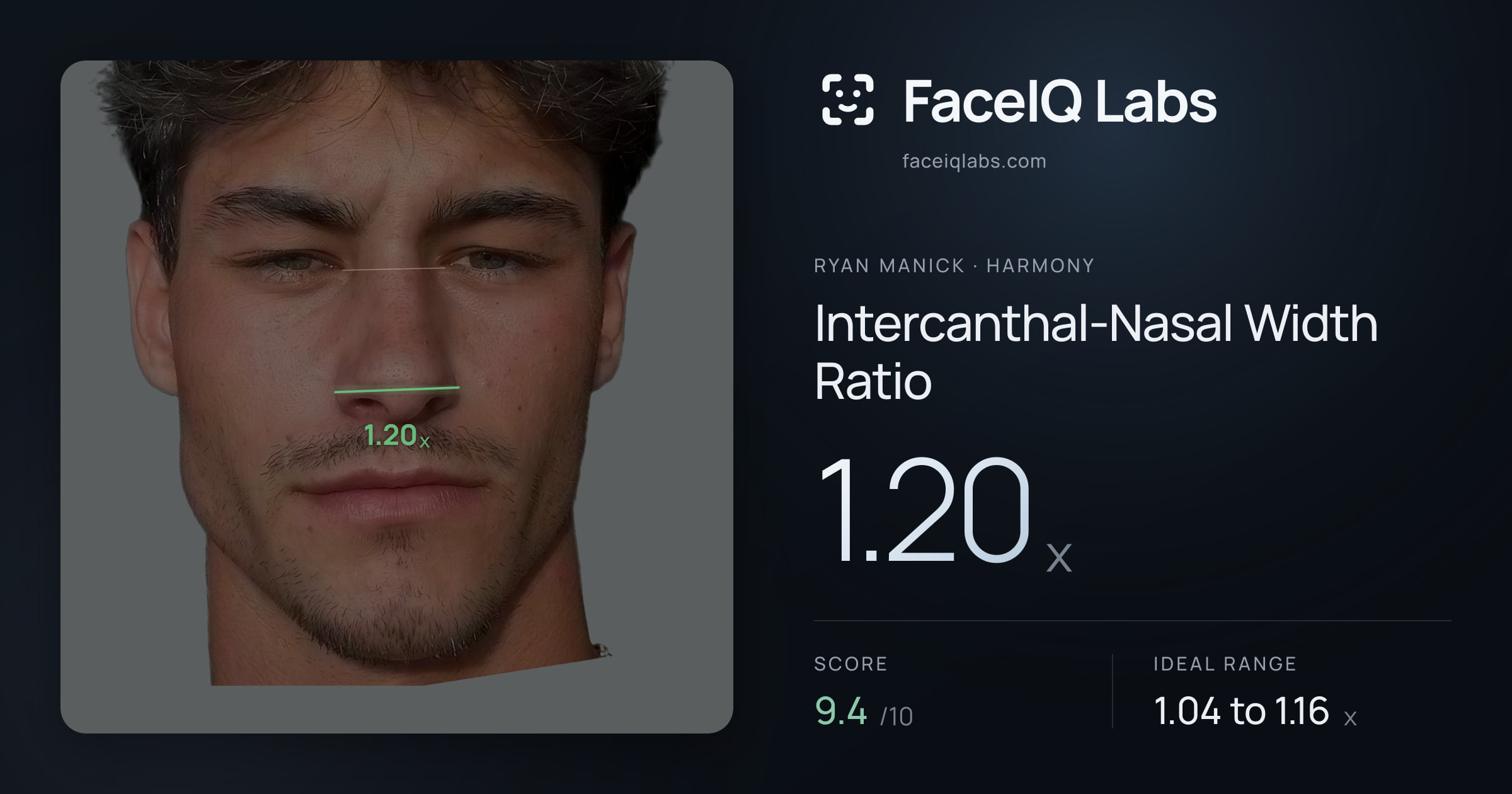 Ryan Manick Intercanthal-Nasal Width Ratio: 1.20x, drawn on the photo