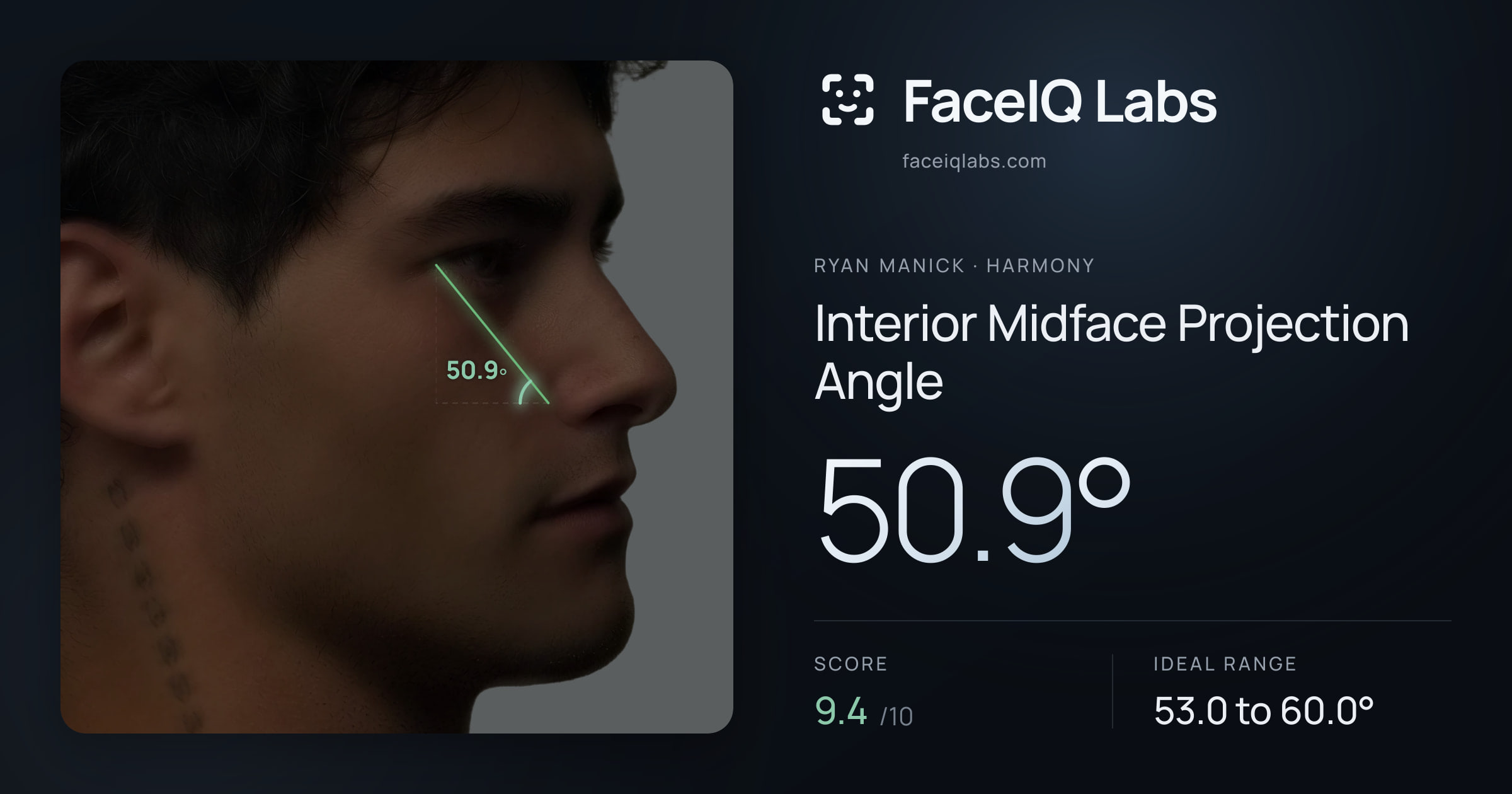 Ryan Manick Interior Midface Projection Angle: 50.9°, drawn on the photo