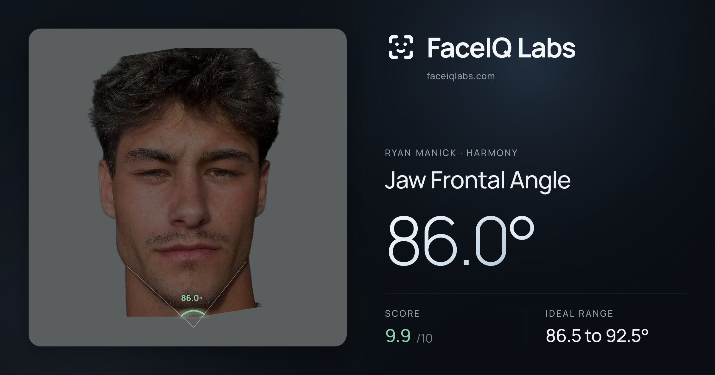 Ryan Manick Jaw Frontal Angle: 86.0°, drawn on the photo