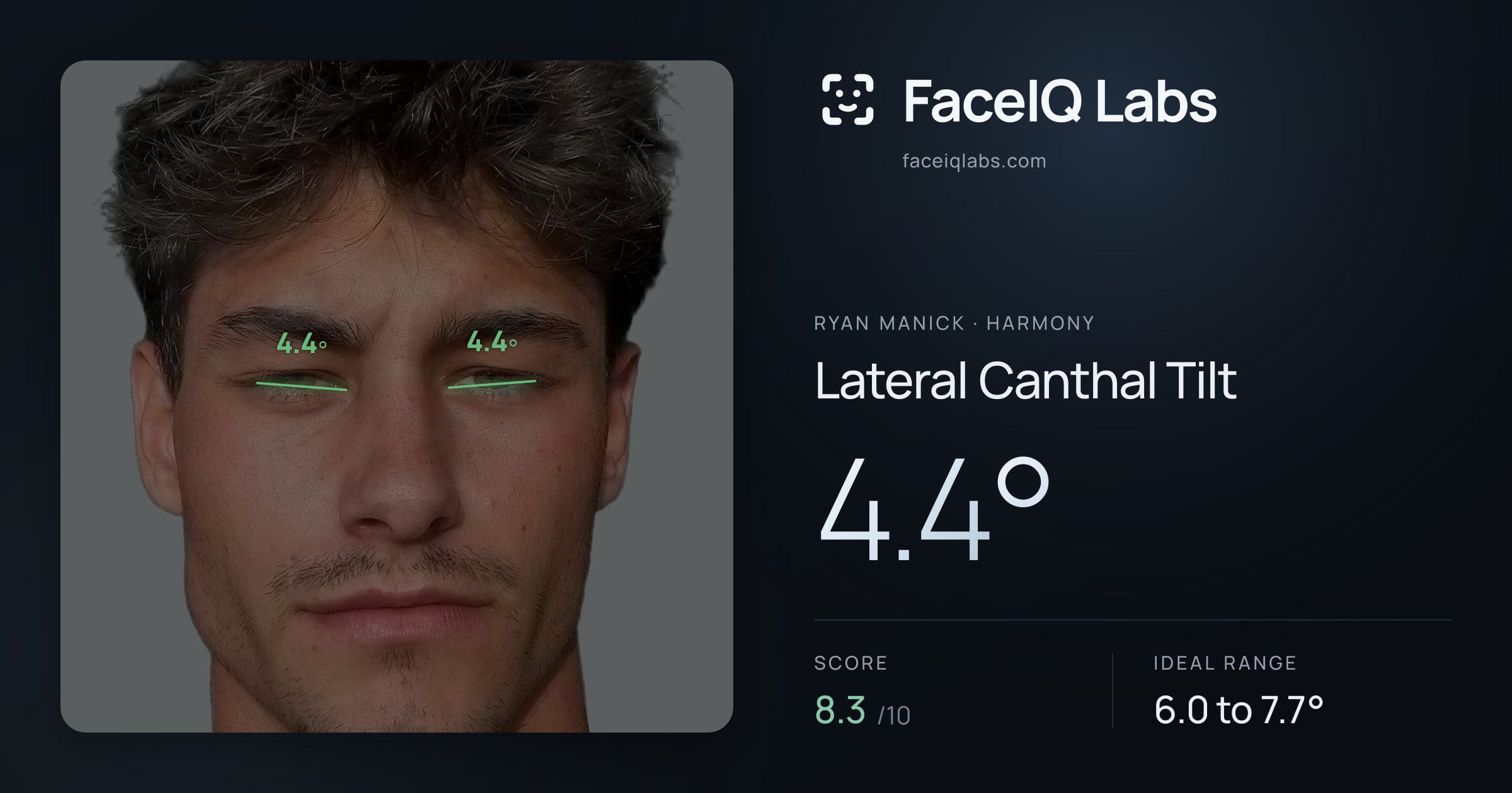 Ryan Manick Lateral Canthal Tilt: 4.4°, drawn on the photo