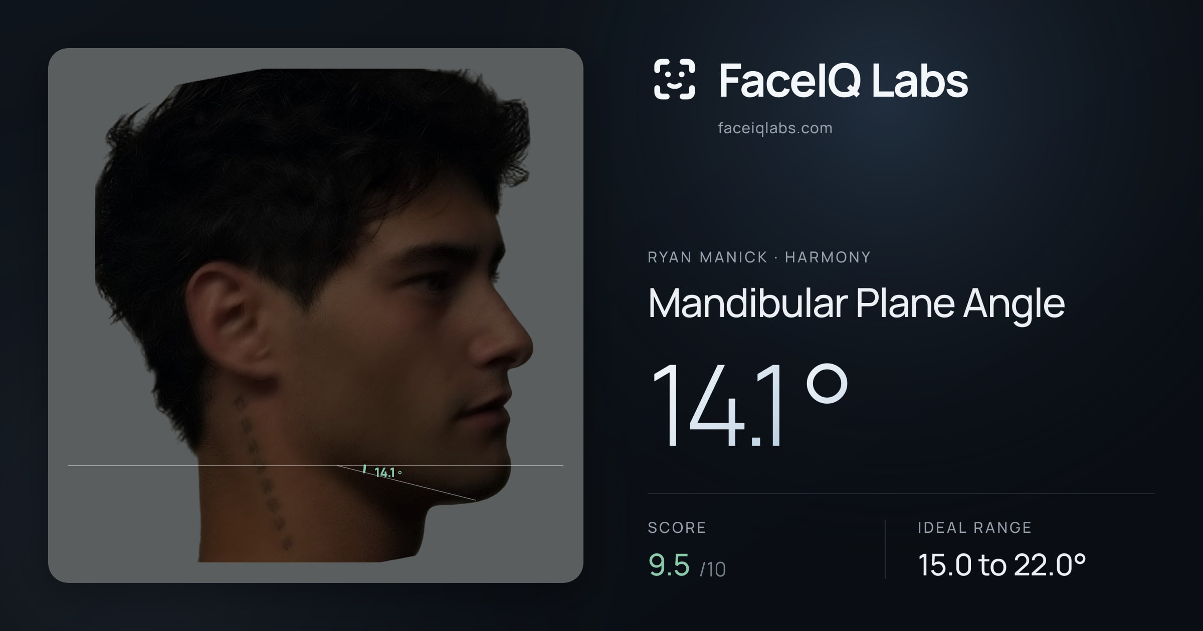 Ryan Manick Mandibular Plane Angle: 14.1°, drawn on the photo
