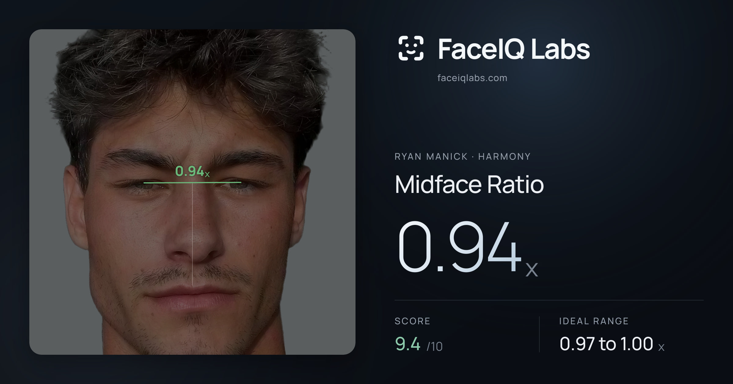 Ryan Manick Midface Ratio: 0.94x, drawn on the photo