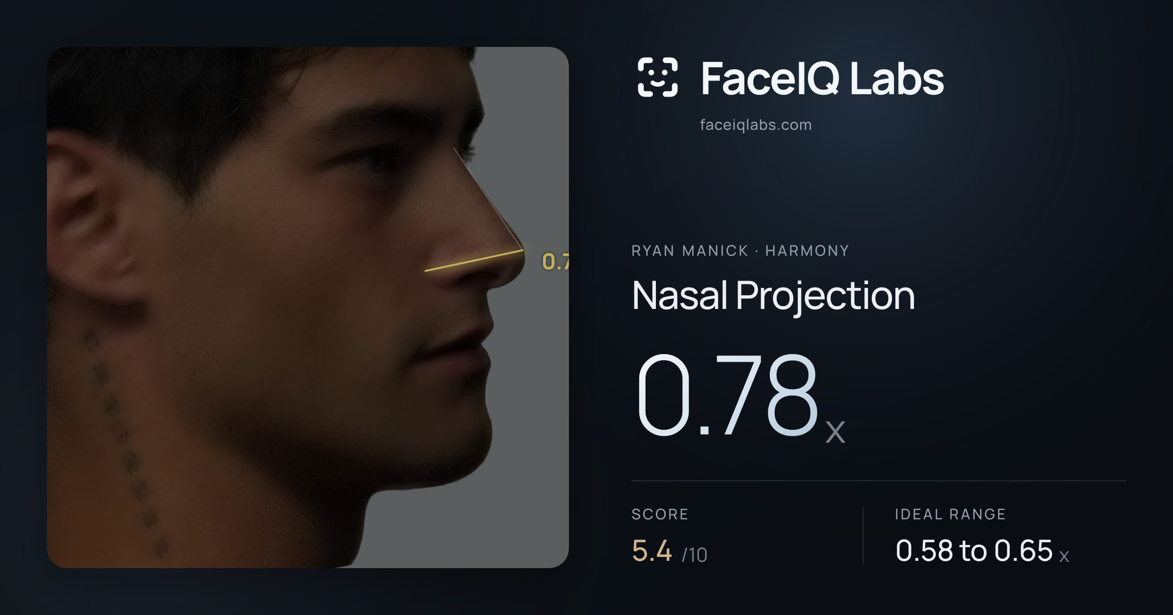 Ryan Manick Nasal Projection: 0.78x, drawn on the photo