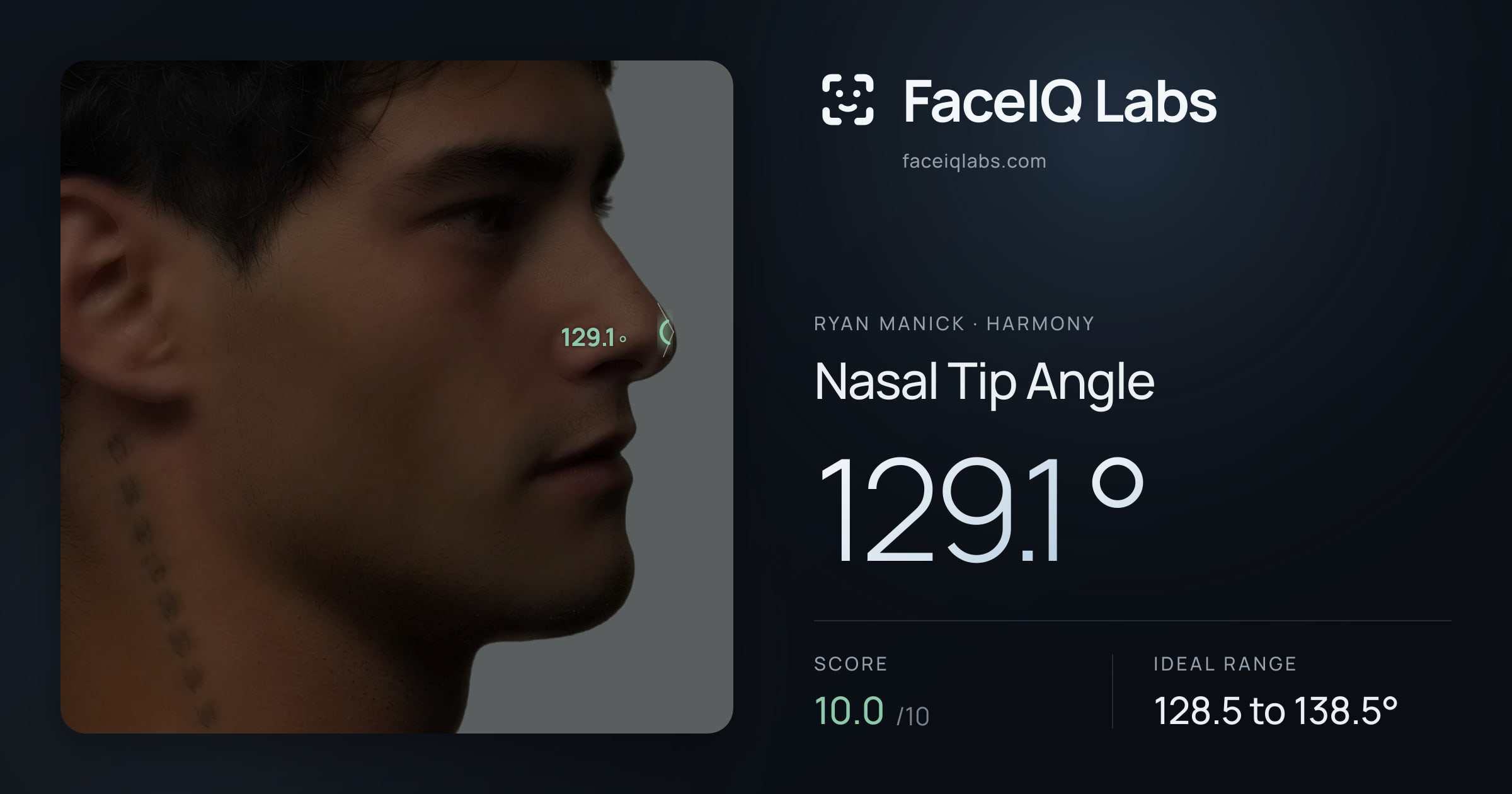 Ryan Manick Nasal Tip Angle: 129.1°, drawn on the photo
