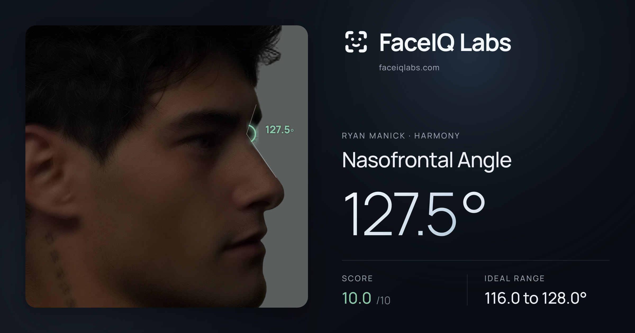 Ryan Manick Nasofrontal Angle: 127.5°, drawn on the photo