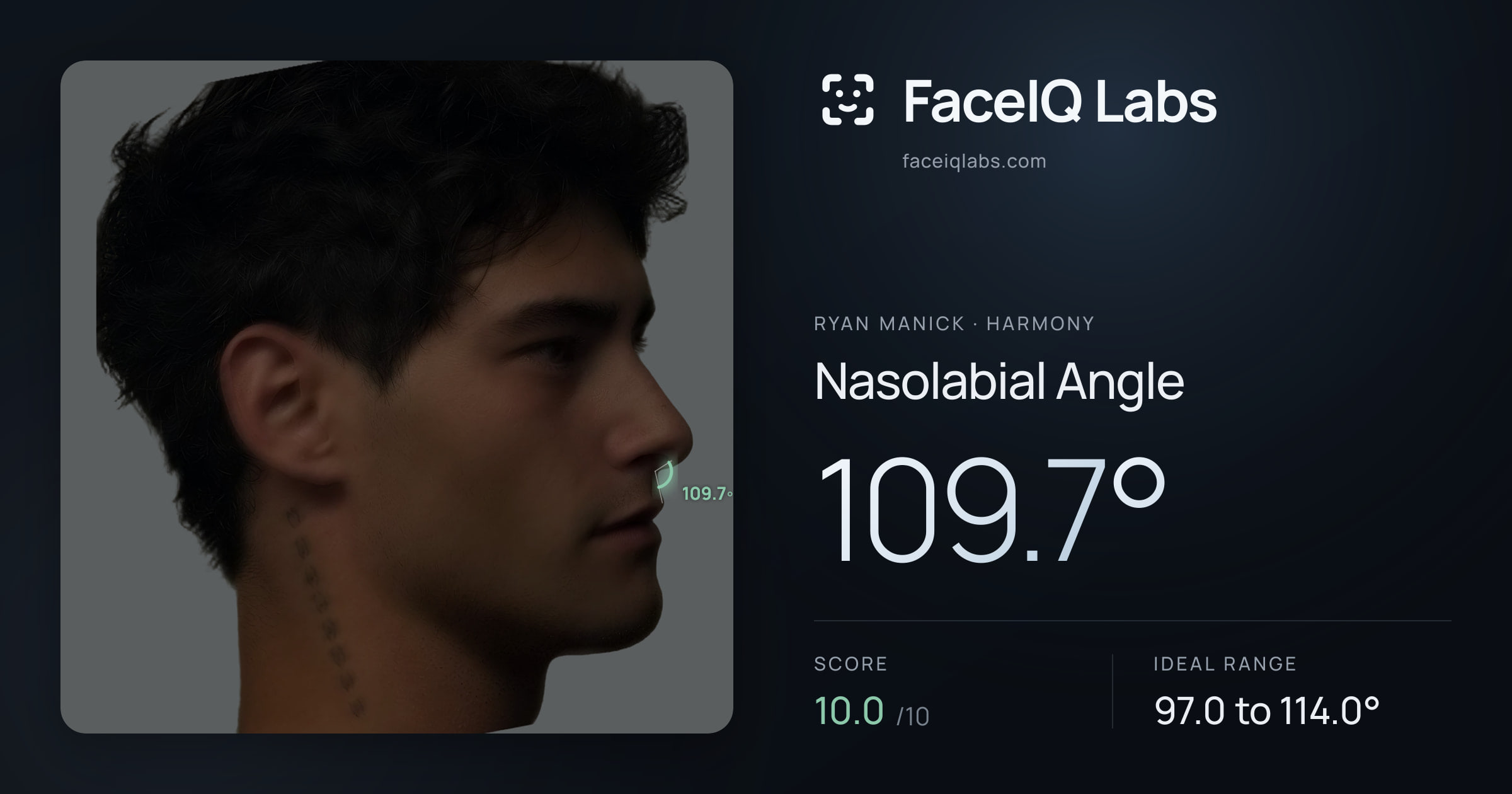 Ryan Manick Nasolabial Angle: 109.7°, drawn on the photo