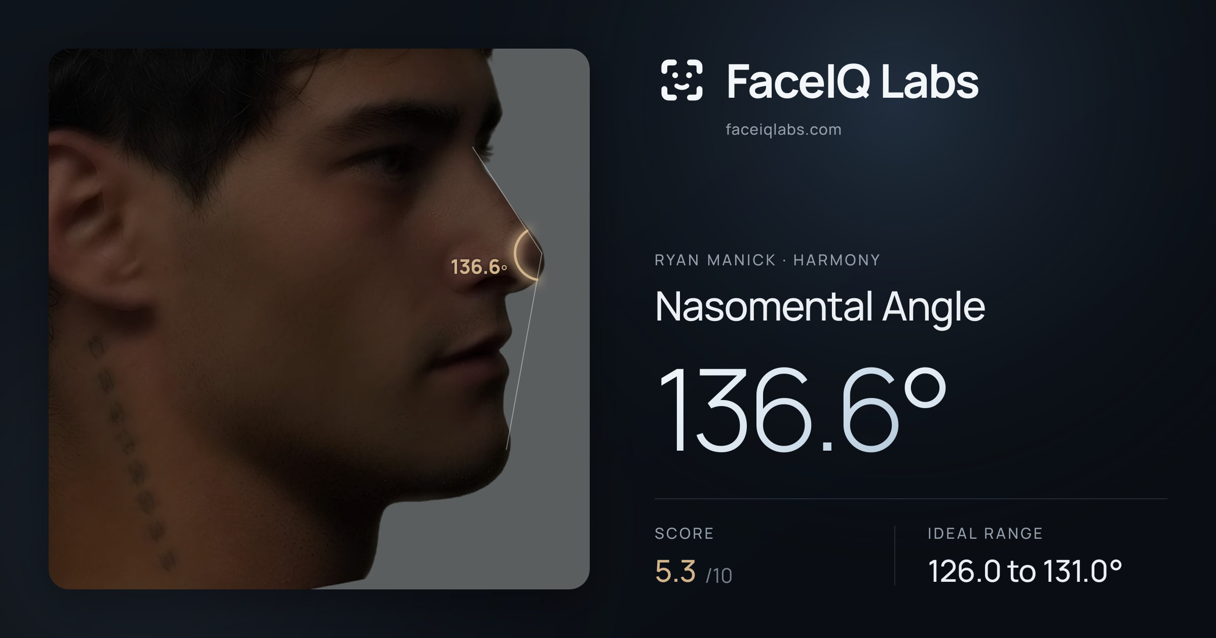 Ryan Manick Nasomental Angle: 136.6°, drawn on the photo